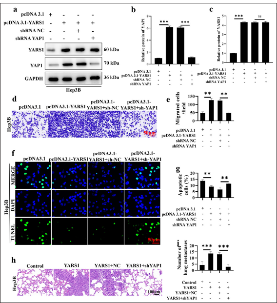 Silencing yes-associated protein 1 (YAP1) reverses the tumor-promoting effect of Tyrosyl-tRNA synthetase 1 (YARS1). (a-c) Western blot was conducted to verify the changes in YARS1 and YAP1 expression levels in different treatment groups. (d and e) Transwell assay was performed to examine the effect of YAP1 silencing on the tumor-promoting function of YARS1. (f and g) Terminal deoxynucleotidyl transferase dUTP nick end labeling assay to verify the effect of YAP1 silencing on the ability of YARS1 to regulate cell apoptosis. (h and i) Six weeks after injecting cells into the tail vein of nude mice, lung metastasis was detected. n = 3. ✶✶ P < 0.01, ✶✶✶ P < 0.001. GAPDH: Glyceraldehyde-3-phosphate dehydrogenase, pcDNA 3.1: Negative control to pcDNA 3.1-YARS1, shRNA NC: Negative control to YAP1 shRNA, NC: Hep3B cells transfected with shRNA NC.