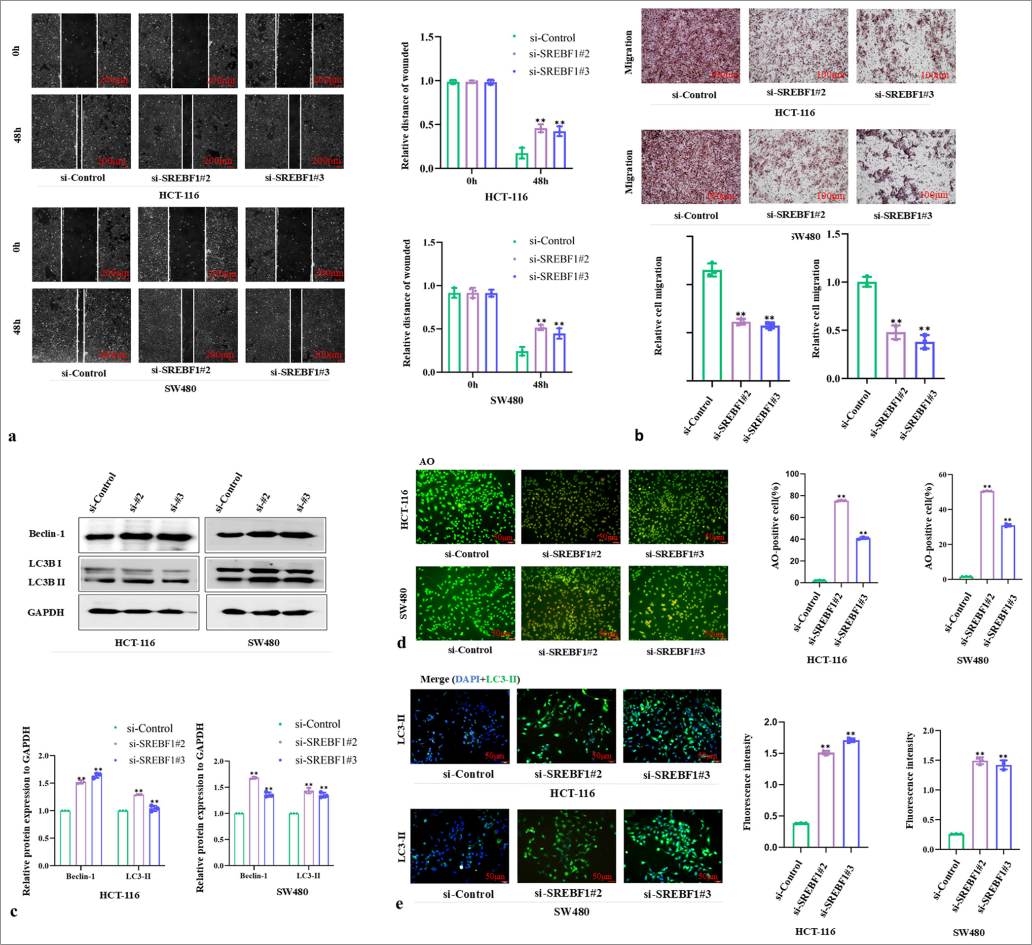 Silencing Sterol Regulatory Element Binding Transcription Factor 1 (SREBF1) can inhibit the migration of colon adenocarcinoma cells and induce autophagy of these cells. (a and b) The effect of SREBF1 silencing on the migration ability of colon adenocarcinoma cells was measured by wound healing and Transwell assays. (c) Detection of the autophagy markers before and after silencing SREBF1 through western blot, and GAPDH was used as a loading control. (d) Acridine orange staining was used to observe the formation of autophagosomes. Magnification: ×200. (e) Immunofluorescence staining of LC3-II in constructed colon adenocarcinoma cells. [Blue: 4’,6-Diamidino-2’-phenylindole (DAPI); Green: Light chain (LC) 3-II], Magnification: ×400. The above experiments underwent replication 3 times (n = 3; ✶✶P < 0.01). GAPDH: Glyceralde-hyde-3-phosphate dehydrogenase.