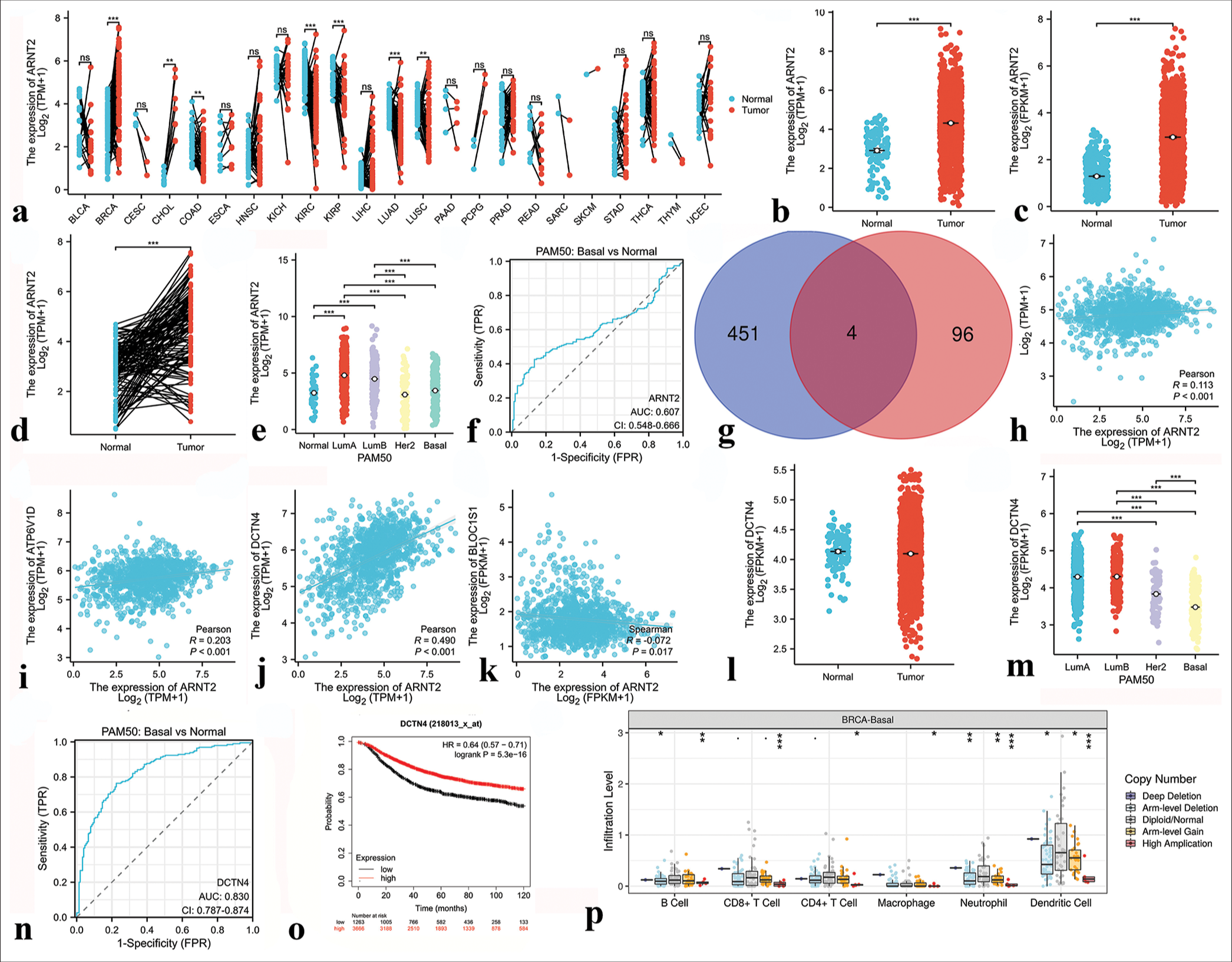 Results of bioinformatics analysis of Aryl hydrocarbon receptor nuclear translocator 2 (ARNT2). (a) Expression of ARNT2 in 23 human tumors. (b and c) The cancer genome atlas (TCGA) and GTEx databases demonstrated the expression levels of ARNT2 in BC and normal tissues. (d) ARNT2 expression in BC (n = 113) and paired normal samples (n = 113) collected by the TCGA database. (e) ARNT2 expression in PAM50 subtypes. (f) Receiver operating characteristic (ROC) curve based on ARNT2 expression level. (g) Venn diagram of the downstream target genes of ARNT2 shared between ChIP-Atlas database and GRNdb database (intersection) and those unique to each database. Blue indicates the downstream target genes in the ChIP-Atlas database, pink indicates the downstream target genes in the GRNdb database, and dark red indicates the common downstream target genes shared by both databases. (h) Correlation analysis between ARNT2 and downstream target gene ATG3. (i) Correlation analysis between ARNT2 and the downstream target gene ATP6V1D. (j) Correlation analysis between ARNT2 and the downstream target gene DCTN4. (k) Correlation analysis between ARNT2 and the downstream target gene BLOC1S1. (l) DCTN4 expression in breast cancer (n = 1113) and normal samples (n = 113) collected from the TCGA database. (m) DCTN4 expression in the PAM50 subtypes. (n) ROC curve based on DCTN4 expression level. (o) Correlation between DCTN4 expression level and prognosis. (p) Correlation analysis of ARNT2 with immune cells in triple-negative breast cancer. ✶P < 0.05, ✶✶P < 0.01, ✶✶✶P < 0.001. FPR: False positive rate, PAM50: Prediction analysis of microarray 50, FPKM: Fragments per kilobase of exon per million mapped fragments, TPM: Transcripts per million reads, HR: Hazard ratio.