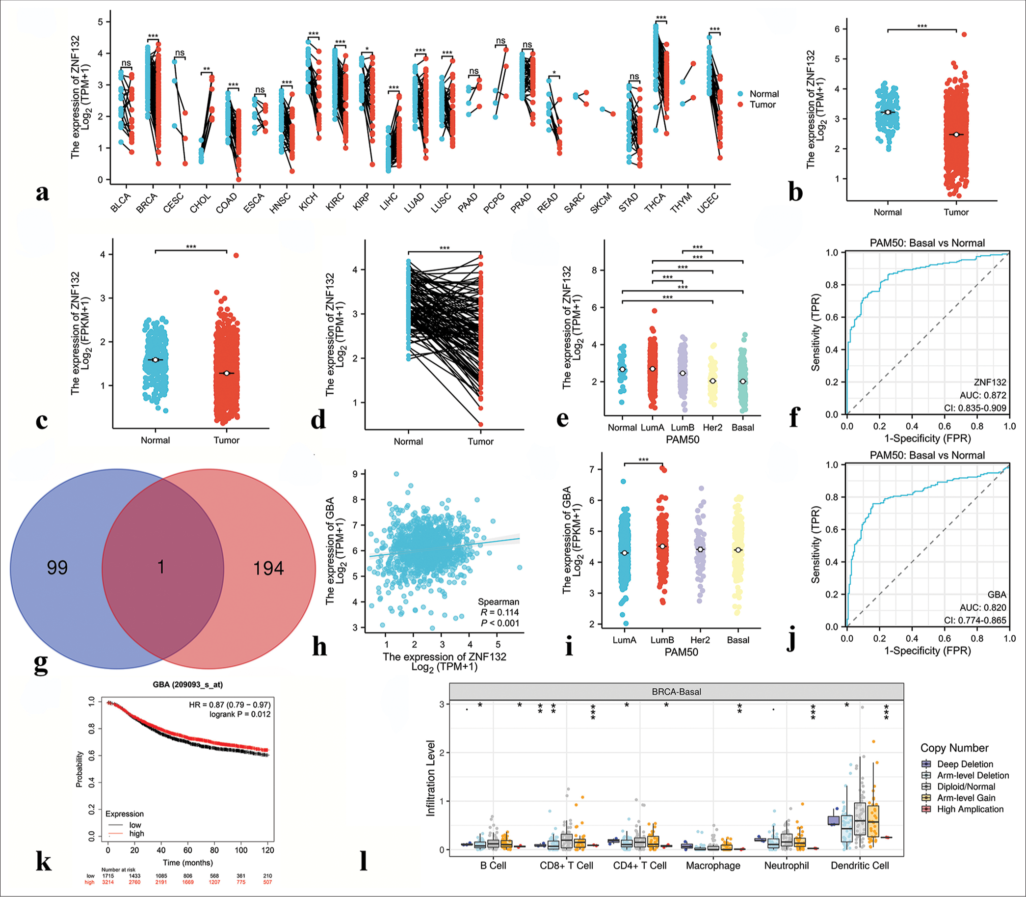 Results of bioinformatics analysis of zinc finger protein 132 (ZNF132). (a) Expression of ZNF132 in 23 human tumors. (b and c) The cancer genome atlas (TCGA) and GTEx databases demonstrated the expression levels of ZNF132 in BC and normal tissues. (d) ZNF132 expression in BC (n = 113) and paired normal samples (n = 113) collected from the TCGA database. (e) ZNF132 expression in the PAM50 subtypes. (f) Receiver operating characteristic (ROC) curve based on ZNF132 expression level. (g) Venn diagram of the downstream target genes of ZNF132 shared between Cistrome Data Browser database and GRNdb database (intersection) and those unique to each database. Blue indicates the downstream target genes in the Cistrome Data Browser database, pink indicates the downstream target genes in the GRNdb database, and dark red indicates the common downstream target genes shared by both databases. (h) Correlation analysis between ZNF132 and downstream target gene GBA. (i) GBA expression in PAM50 subtypes. (j) ROC curve based on GBA expression level. (k) Correlation between GBA expression level and prognosis. (l) Correlation analysis of ZNF132 with immune cells in triple-negative breast cancer. ✶P < 0.05, ✶✶P < 0.01, ✶✶✶P < 0.001. PAM50: Prediction Analysis of Microarray 50, ZNF: Zinc finger protein, FPKM: Fragments per kilobase of exon model per million mapped fragments, FPR: False positive rate, TPM: Transcripts per million reads, GBA: Glucose brain sphingolipidase gene, HR: Hazard ratio, CD4/8: Cluster of differentiation 4/8, AUC: Area under curve: CI: Confidence interval.