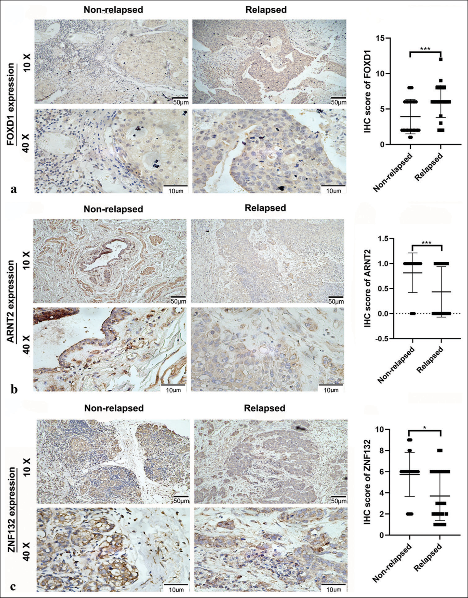 Relative expression of hub transcription factors in 30 tissues with postoperative relapse and 27 without relapse, as detected by immunohistochemistry (IHC). Panel (a) shows Forkhead box D1 (FOXD1) expression, (b) depicts aryl hydrocarbon receptor nuclear translocator 2 expression (ARNT2), and (c) illustrates zinc finger protein (ZNF) 132 expression. ✶P < 0.05, ✶✶✶P < 0.001.