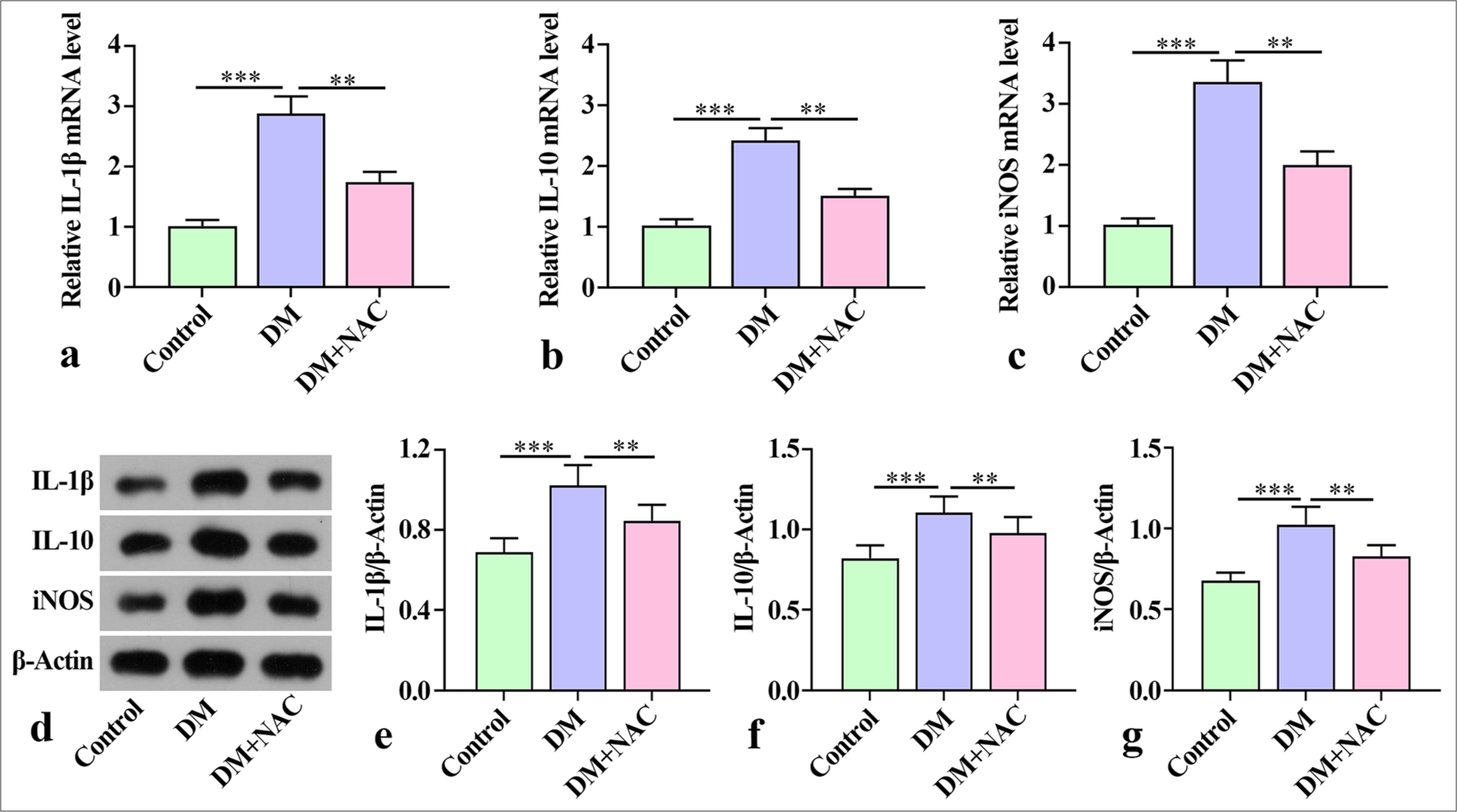 Effect of ROS inhibition on inflammatory factors in mice with diabetes periodontitis. (a-c) Inflammatory cytokines IL-1β, iNOS, and IL-10 mRNA in the mandibles of mice evaluated by qRT-PCR. (d-g) Levels of inflammatory factors IL-1β, IL-10, and iNOS proteins in mouse mandibles detected by Western blot. The experiment was repeated 3 times. ROS: Reactive oxygen species, IL: Interleukin, iNOS: Inducible nitric oxide synthetase, qRT-PCR: Quantitative reverse transcription polymerase chain reaction, DM: diabetes periodontitis model, NAC: ROS inhibitor N-acetylcysteine. ✶✶P < 0.01, ✶✶✶P < 0.001.