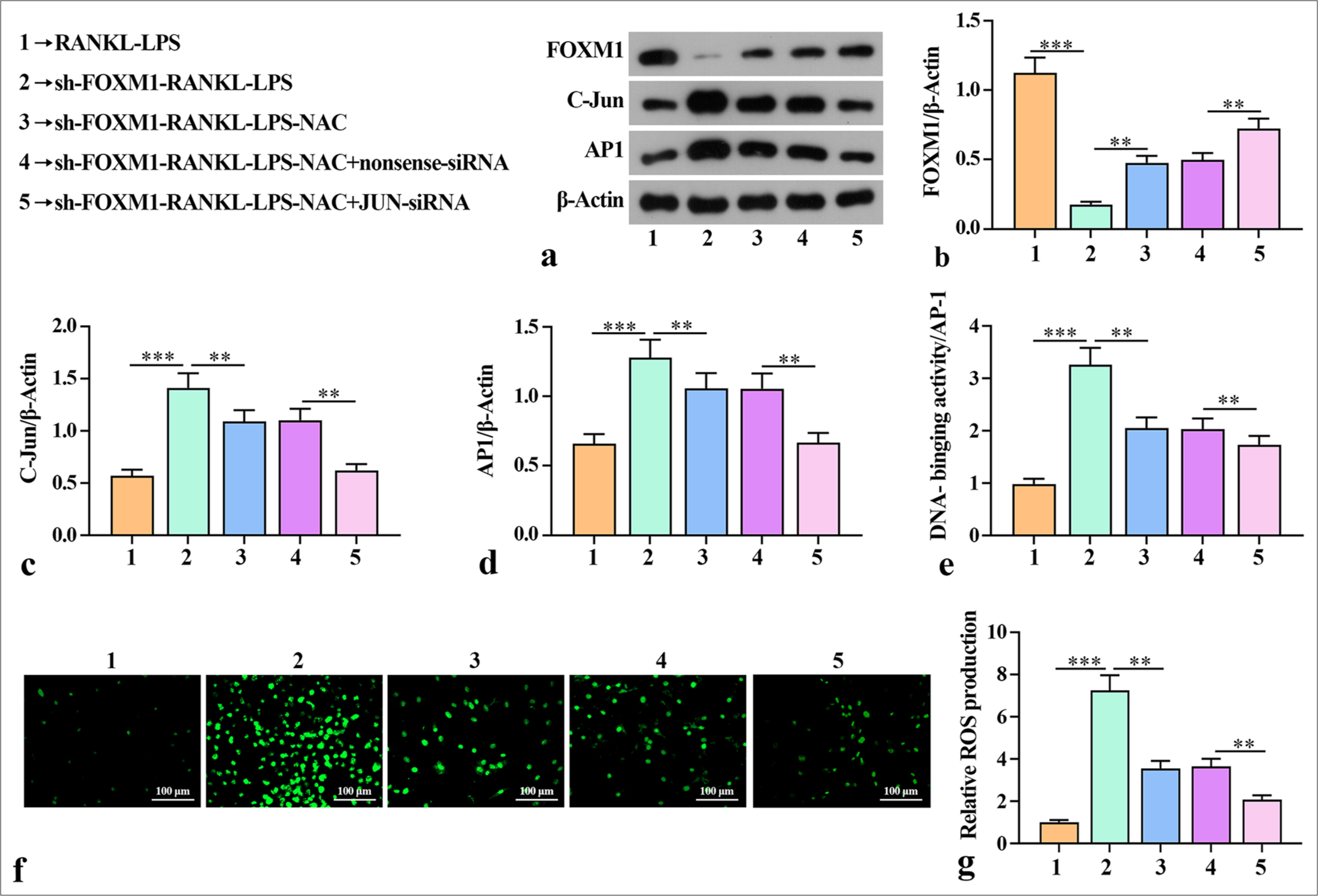 Silencing of FOXM1 mediated the effects of AP-1 on ROS generation during macrophage osteoclast-like differentiation. (a-d) Levels of FOXM1, C-Jun, and AP1 in macrophage cells determined by Western blot. (e) EMSA analysis of AP-1 binding activity in macrophage cells. (f and g) Levels of ROS in macrophage cells determined by the DCFH-DA probe. The experiment was repeated 3 times. RANKL: Receptor activator for nuclear factor κ B ligand, LPS: Lipopolysaccharide, FOXM1: Forkhead box protein M1, NAC: ROS inhibitor N-acetylcysteine, JUN: JUN corresponding to the core subunit C-Jun in AP1 heterodimers, ROS: Reactive oxygen species, AP-1: Activator protein-1, EMSA: Electrophoretic mobility shift assay, DCFH-DA: Dichlorodihydrofluorescein diacetate. ✶✶P < 0.01, ✶✶✶P < 0.001.