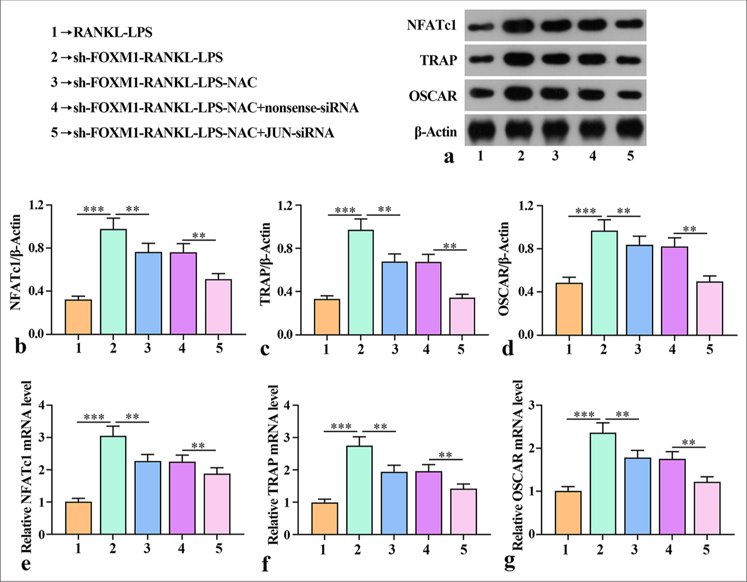 Silencing of FOXM1-regulated ROS production mediated AP-1 activation in the osteoclast differentiation of macrophages. (a-d) Expression of NFATc1, TRAP, and OSCAR proteins in cell lysates evaluated by Western blot. (e-g) Levels of NFATc1, TRAP, and OSCAR mRNA in cell lysates assessed by qRT-PCR. The experiment was repeated 3 times. RANKL: Receptor activator for nuclear factor κ B ligand, LPS: lipopolysaccharide, FOXM1: Forkhead box protein M1, NAC: ROS inhibitor N-acetylcysteine, JUN: JUN corresponding to the core subunit C-Jun in AP1 heterodimers, ROS: Reactive oxygen species, AP-1: Activator protein-1, NFATc1: Nuclear factor-activated T cell c1, TRAP: Tartrate-resistant acid phosphatase, OSCAR: Osteoclast-associated receptor, qRT-PCR: Quantitative reverse transcription polymerase chain reaction. ✶✶P < 0.01, ✶✶✶P < 0.001.