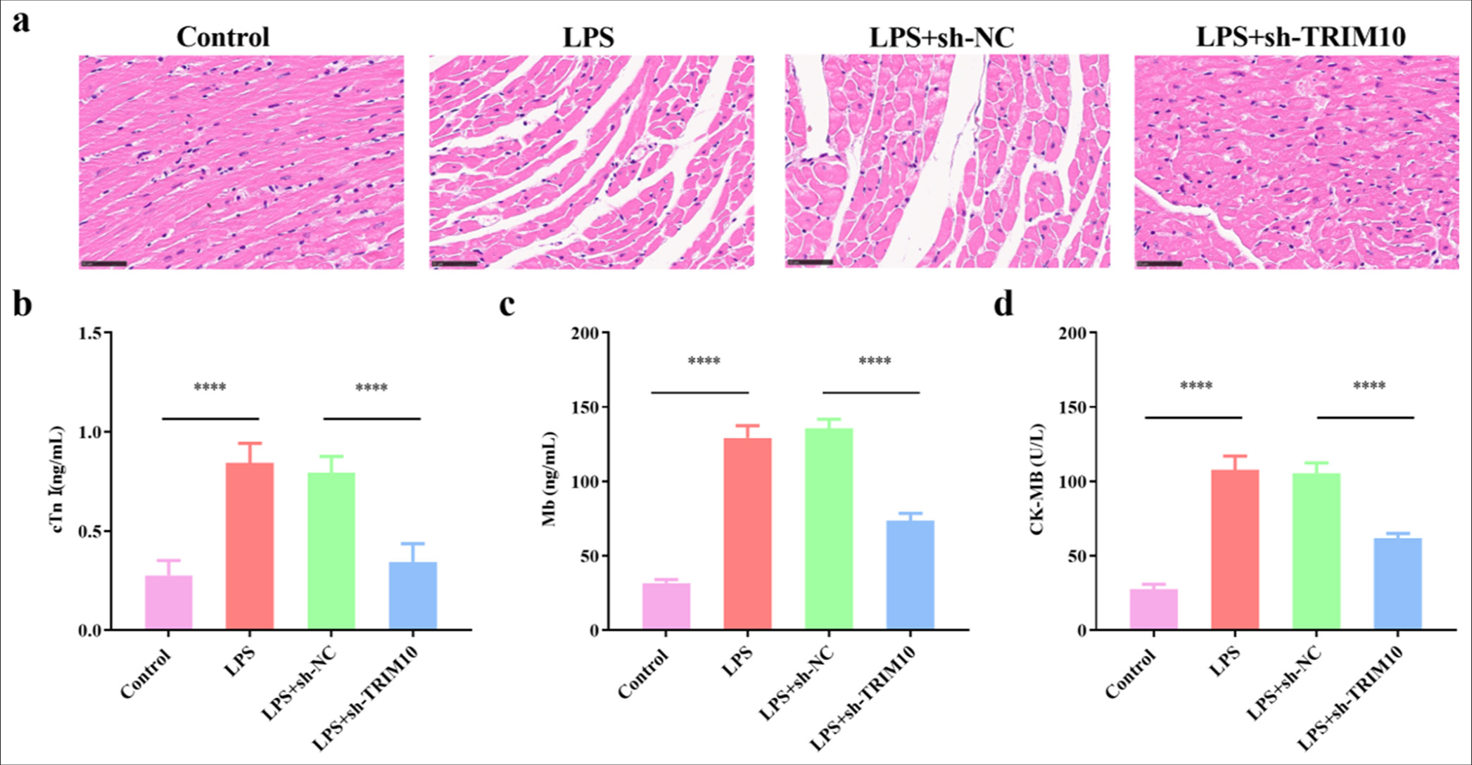 Knockdown of TRIM10 repress myocardial damage in SCM model. (a) HE staining, magnification 100x, showed the pathological changes of myocardial tissues in each group (scale: 50 μm). The contents of cTnI (b), Mb (c), CK-MB (d) were detected by ELISA. ✶✶✶✶P<0.0001, n=5. SCM: Septic cardiomyopathy, HE: Hematoxylin-eosin, cTnI: Cardiac troponin I, Mb: Myohemoglobin, CK-MB: Creatine kinase-MB, ELISA: Enzyme-linked immunosorbent assay, TRIM10: Tripartite motif 10, LPS: Lipopolysaccharide, sh-NC: short hairpin-negative control.