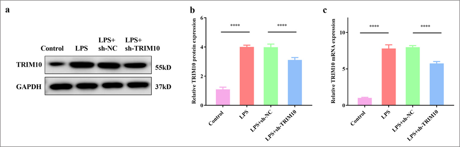 TRIM10 was knocked down in H9C2 cells. (a and b) Protein expression of TRIM10 was detected by Western blot assay. (c) The mRNA expression of TRIM10 was detected by RT-qPCR. ✶✶✶✶P<0.0001, n=5. RT-qPCR: Reverse transcription-polymerase chain reaction. TRIM10: Tripartite motif 10, LPS: Lipopolysaccharide, sh-NC: short hairpin-negative control.