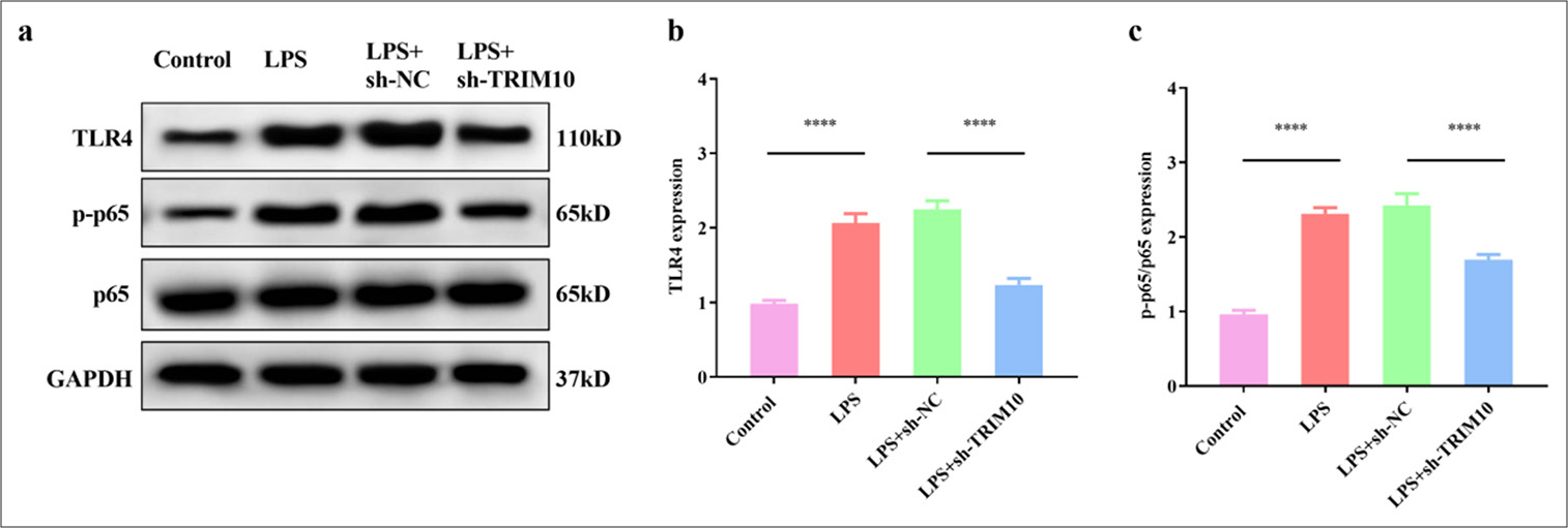 Knockdown of TRIM10 restrains the activation of the TLR4/NF-κB signaling pathway. (a-c) Expression of p65, p-p65, and TLR4 in each group was detected by Western blot assay. ✶✶✶✶P<0.0001, n=5. TLR4: Toll-like receptor 4, NF-κB: Nuclear transcription factor-κB, TRIM10: Tripartite motif 10, LPS: Lipopolysaccharide, sh-NC: short hairpin-negative control, GAPDH: Glyceraldehyde-3-phosphate dehydrogenase.