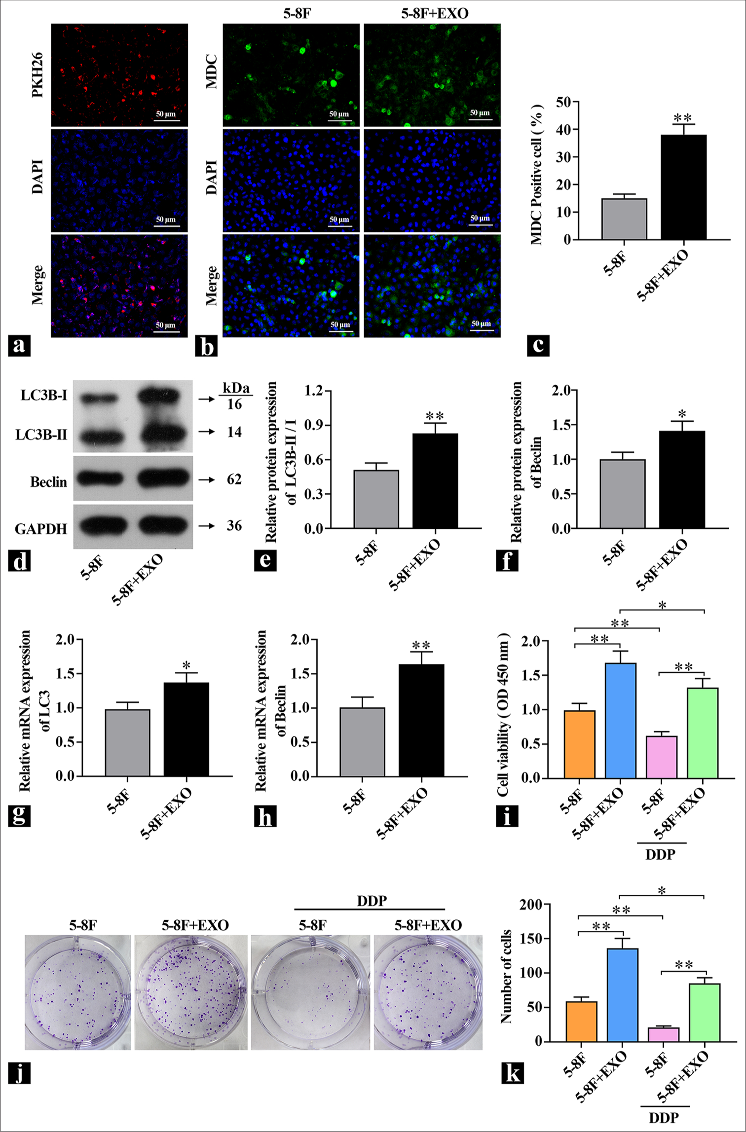 Exosome introduction increases autophagy levels in 5-8F cells. (a) KH26 detection of exosome transfection efficiency. (b and c) Representative images of MDC staining to detect autophagic flux. (d-f) Western blot detection of autophagy hallmark protein content (n=3). (g and h) real-time polymerase chain reaction detection of autophagy hallmark gene expression levels (n=3). (i) Assessment of the effect of exosomes on 5-8F cell viability (n=3). (j and k) Colony formation assay to detect the effect of exosomes on cell proliferation capability. ✶P<0.05, ✶✶P<0.01. 5-8F: Nasopharyngeal carcinoma cell line, MDC: Monodansylcadaverine, KH26: PKH-26 (RED) Exosome tracer dye, DDP: Cisplatin-diamminedichloroplatinum, EXO: Exosome.