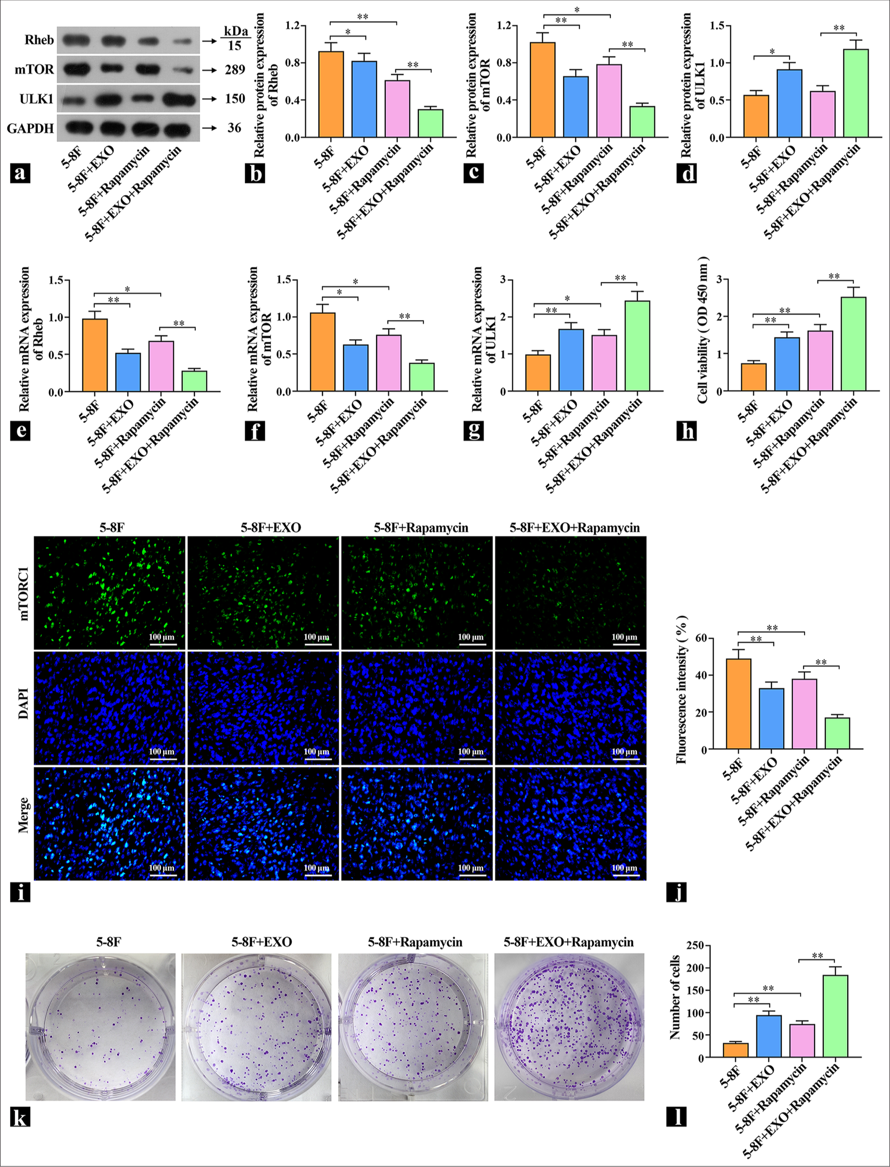 Exosomes promote protective cell autophagy by regulating Ras homologue enriched in brain (Rheb)/mTOR. (a-d) The protein levels of Rheb, mammalian target of rapamycin complex (mTORC1), and UNC51-like kinase (ULK1) were detected by Western blot (n=3). (e-g) The mRNA expression levels of Rheb, mTOR, and ULK1 were detected by real-time polymerase chain reaction (n=3). (h) The effects of exosomes and rapamycin on the viability of 5-8F cells were examined (n=3). (i and j) Representative images of mTORC1 content detected by immunofluorescence. (k and l) The effects of exosomes and rapamycin on cell proliferation were detected by cell colony formation assay. ✶P<0.05, ✶✶P<0.01. 5-8F: Nasopharyngeal carcinoma cell line, EXO: Exosome.