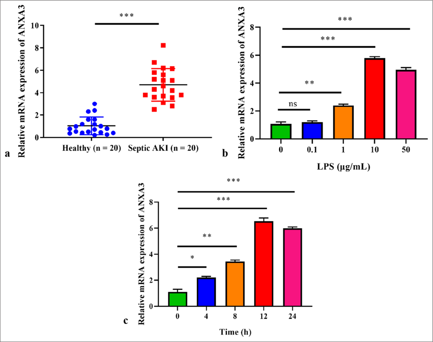 High level of annexin A3 (ANXA3) is observed in patients with sepsis and acute kidney injury (AKI) and lipopolysaccharide (LPS)-induced HK2 cells. (a) ANXA3 expression in the serum samples of patients with sepsis and AKI was detected by quantitative real-time polymerase chain reaction (qRT-PCR). ✶✶✶P < 0.001 versus healthy control. (b) Following treatment with different concentrations of LPS, ANXA3 expression in HK2 cells was determined through qRTPCR. ✶✶P < 0.01, ✶✶✶P < 0.001 versus 0 μg/mL LPS. ns: No significance. (c) ANXA3 expression in HK2 cells treated with LPS for different durations was detected by qRT-PCR. ✶P < 0.05, ✶✶P < 0.01, ✶✶✶P < 0.001 versus 0 h. All in vitro experiments were conducted in triplicate with at least three independent experiments. mRNA: Messenger ribonucleic acid, HK2: Human kidney 2.