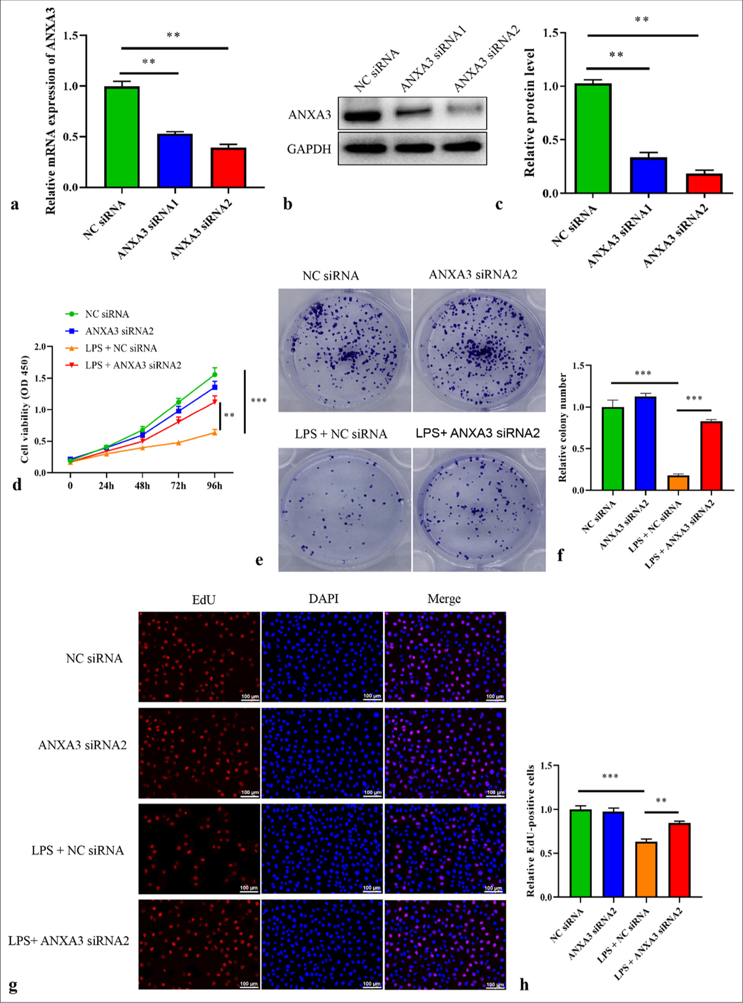 Knocking down annexin A3 (ANXA3) induces the proliferative capacities of Lipopolysaccharide-induced human kidney 2 (HK2) cells. (a) ANXA3 mRNA expression in HK2 cells transfected with ANXA3 siRNA1/2 or negative control siRNA (NC siRNA) was detected by quantitative real-time polymerase chain reaction. ✶✶P < 0.01 versus NC siRNA. (b and c) ANXA3 protein levels in HK2 cells transfected with ANXA3 siRNA1/2 or NC siRNA were measured through Western blot analysis. ✶✶P < 0.01 versus NC siRNA. (d) Cell viability was measured through the cell counting kit-8 assay. ✶✶P < 0.01, ✶✶✶P < 0.001. (e and f) The relative colony number of HK2 cells was assessed through colony formation experiments. ✶✶✶P < 0.001. (g and h) Relative 5-ethynyl-2'-deoxyuridine (EdU)-positive cells were analyzed by using an EdU proliferation assay kit. ✶✶P < 0.01, ✶✶✶P < 0.001. Scale bar = 100 μm. All in vitro experiments were conducted in triplicate with at least three independent experiments. mRNA: Messenger ribonucleic acid, si-RNA: Small interfering RNA, NC: Negative control, GAPDH: Glyceraldehyde-3-phosphate dehydrogenase, HK2: Human kidney 2, LPS: Lipopolysaccharide.