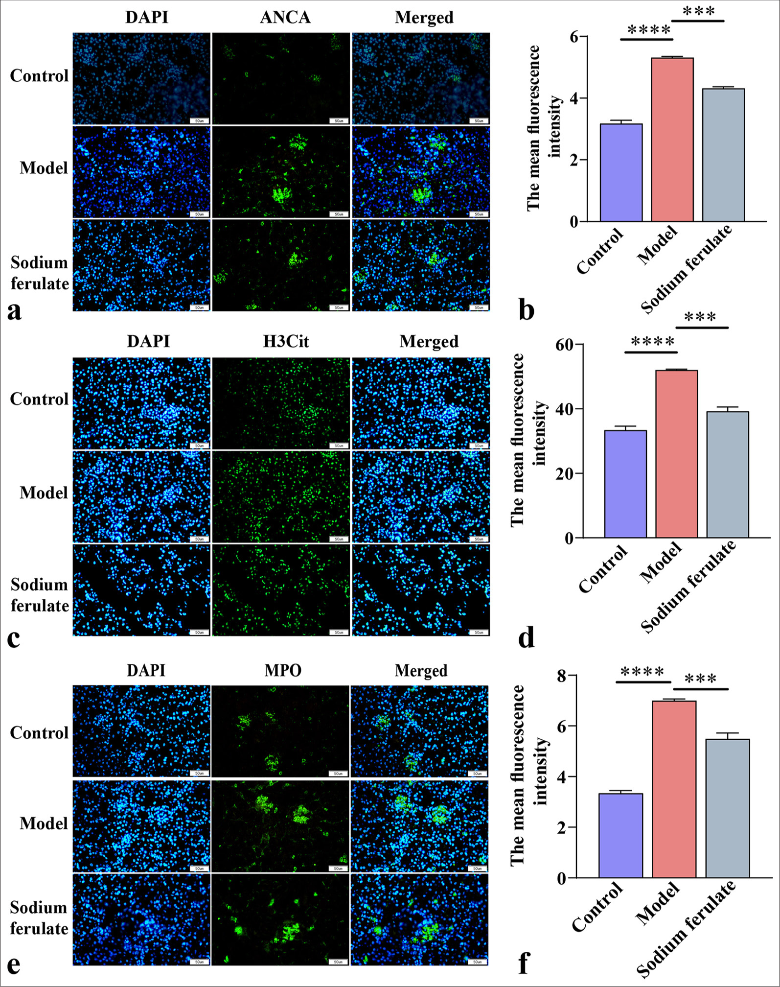 Immunofluorescence microscopy of ANCA, H3Cit, and MPO. (a and b) ANCA immunofluorescence microscopy observation and its average fluorescence intensity; (c and d) H3Cit immunofluorescence microscopy observation and its average fluorescence intensity; (e and f) MPO immunofluorescence microscopy observation and its average fluorescence intensity at original magnification (×400). Scale bar = 50 μm. Data of three independent experiments are presented as mean ± SD and subjected to ordinary one-way ANOVA (“✶✶✶” indicates statistically significant difference at P < 0.001, and “✶✶✶✶” indicates extremely significant difference at P < 0.0001. DAPI: 4',6-Diamidino-2-phenylindole, H3Cit: Histone H3 citrullinated, ANCA: Antineutrophil cytoplasmic antibody, MPO: Myeloperoxidas e, ANOVA: Analysis of variance).