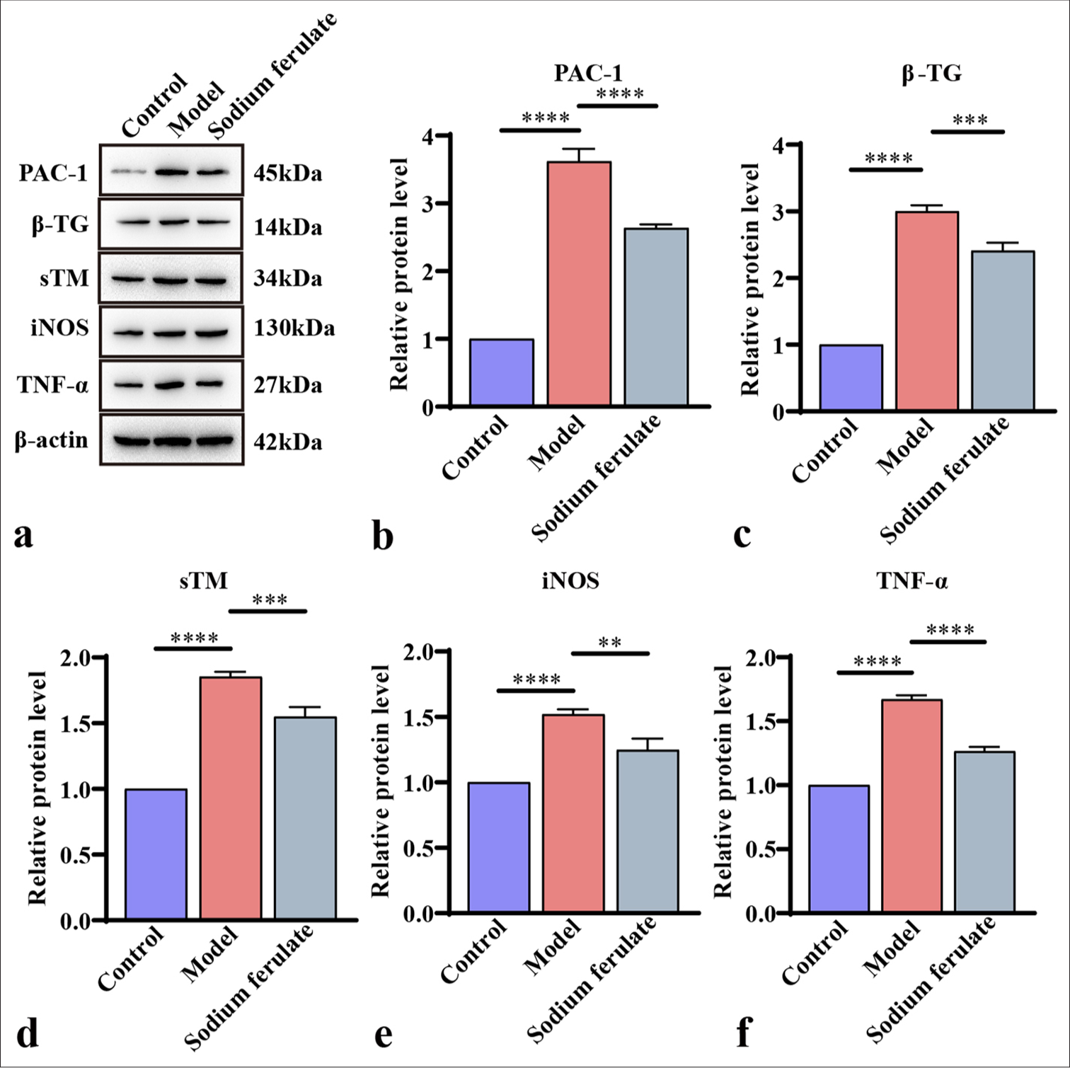 Efficacy of sodium ferulate in affecting content of PAC-1, β-TG, sTM, iNOS, and TNF-α in the kidney tissues of MPO-AAV mice. (a) Western blot detection of the protein bands of PAC-1, β-TG, sTM, iNOS, and TNF-α; (b) grayscale analysis of PAC-1 bands; (c) grayscale analysis of β-TG bands; (d) grayscale analysis of sTM bands; (e) grayscale analysis of iNOS bands; (f) grayscale analysis of TNF-α bands. Data of three independent experiments are presented as mean ± SD and subjected to ordinary one-way ANOVA (“✶✶” indicates a statistically significant difference at P < 0.01, “✶✶✶” indicates a highly significant difference at P < 0.001, and “✶✶✶✶” indicates extremely significant difference at P < 0.0001. PAC-1: Procaspase-activating compound-1, β-TG: β-Trace protein, sTM: Soluble thrombomodulin, iNOS: Inducible nitric oxide synthase, TNF-α: Tumor necrosis factor-α, MPO: Myeloperoxidase, AAV: Associated vasculitis, ANOVA: Analysis of variance, SD: Standard deviation).