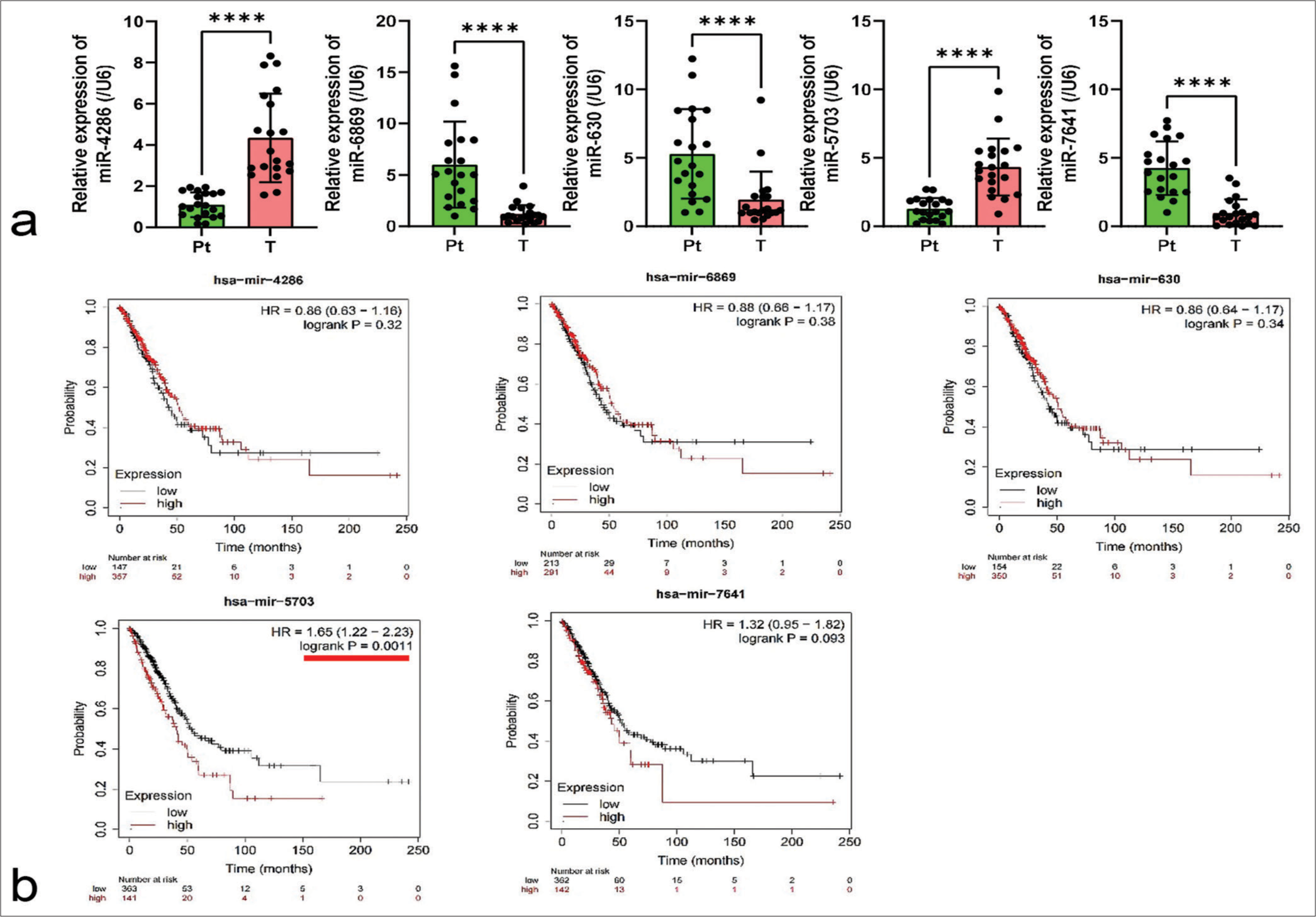 Expression profiling and clinical relevance of microRNA-5703 (miR-5703) in lung cancer. (a) Quantitative polymerase chain reaction detection of the relative expression levels of miR-4286, miR-6869, miR-630, miR-5703, and miR-7641 in lung cancer tissues compared with peri-cancerous tissues. Significant difference in the expression of each microRNA was found between the groups. (b) Kaplan– Meier survival analysis revealed the significant correlations of miR-4286, miR-6869, miR-630, miR-5703, and miR-7641 expression levels to patient prognosis. n = 20, ✶✶✶✶P < 0.0001 versus peri-cancerous tissues. Pt: peri-cancerous tissues; T: lung cancer tissues