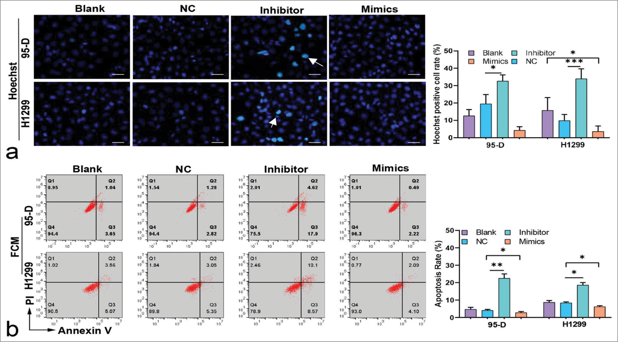 Impact of microRNA-5703 (miR-5703) modulation on apoptosis in lung cancer cells. (a) Hoechst staining images showing increased apoptosis in lung cancer cells treated with the miR-5703 inhibitors and decreased apoptosis after treatment with mimics. White arrows indicate apoptotic cells. Scale: 20 μm. (b) Flow cytometry results reflecting those of Hoechst staining showing change in apoptosis levels after the treatments. n = 3, ✶P < 0.05, ✶✶P < 0.01. NC: Negative Control.