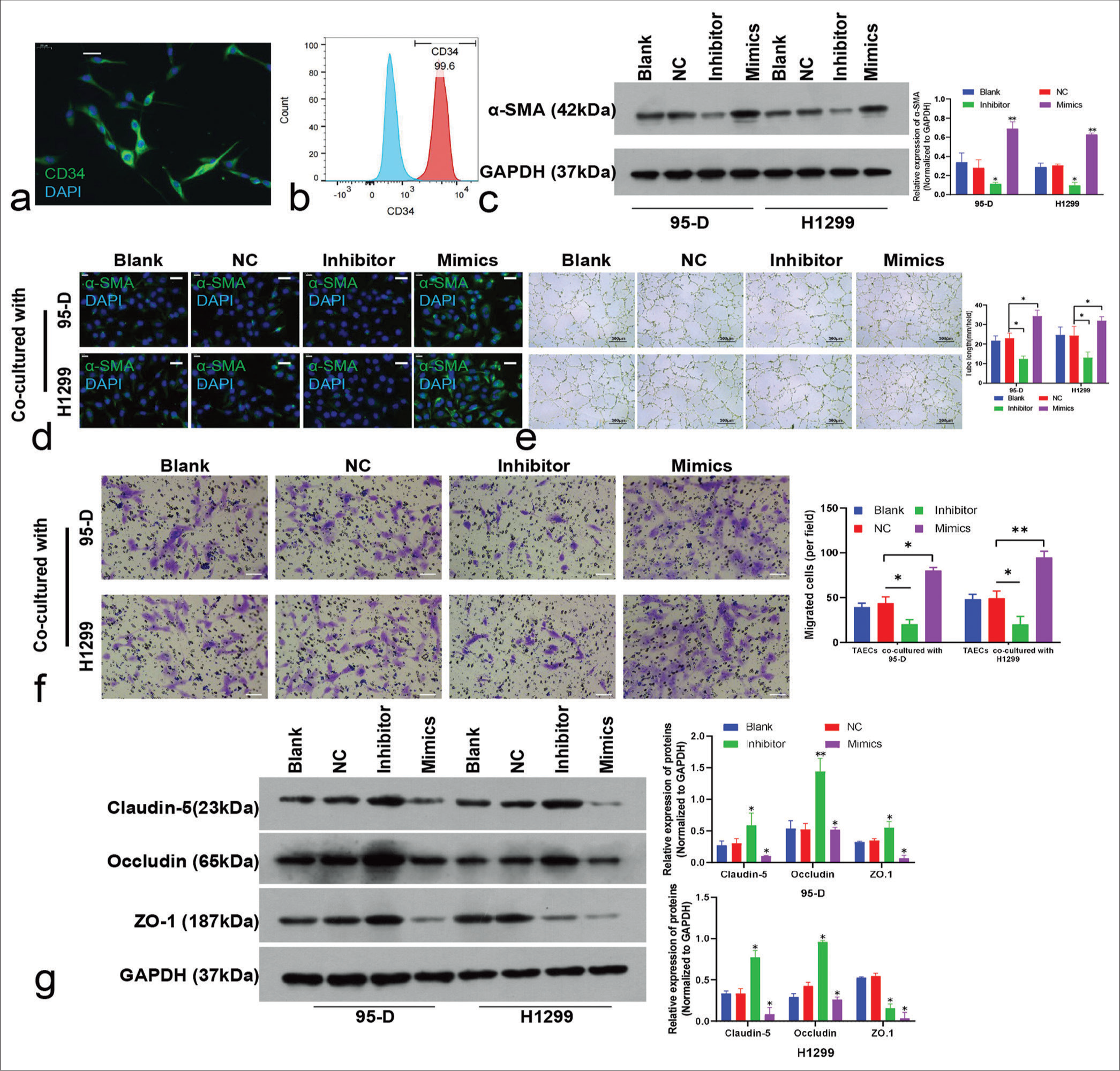 Influence of microRNA-5703 (miR-5703) modulation in lung cancer cells on tumor-associated endothelial cells (TAECs). (a) Immunofluorescence visualization (scale: 20 μm) and (b) flow cytometry quantification revealing >90% CD34-positive ratio in isolated TAECs from lung cancer tissues. (c-d) Western blot (c) and immunofluorescence (d, scale: 20 μm) displayed change in α-smooth muscle actin (α-SMA) expression in endothelial cells upon co-culture with lung cancer cells treated with miR-5703 inhibitors or mimics. GADPH: glyceraldehyde-3-phosphate dehydrogenase. (e-f) Variation in the angiogenesis (e) and migration (f, scale: 50 μm) of endothelial cells after co-cultivation. (g) Western blot analysis of Claudin-5, Occludin and ZO-1 protein expression in endothelial cells co-cultured with lung cancer cells treated with inhibitors or mimics. n = 3, ✶P < 0.05, ✶✶P < 0.01 versus negative control. NC: Negative Control.