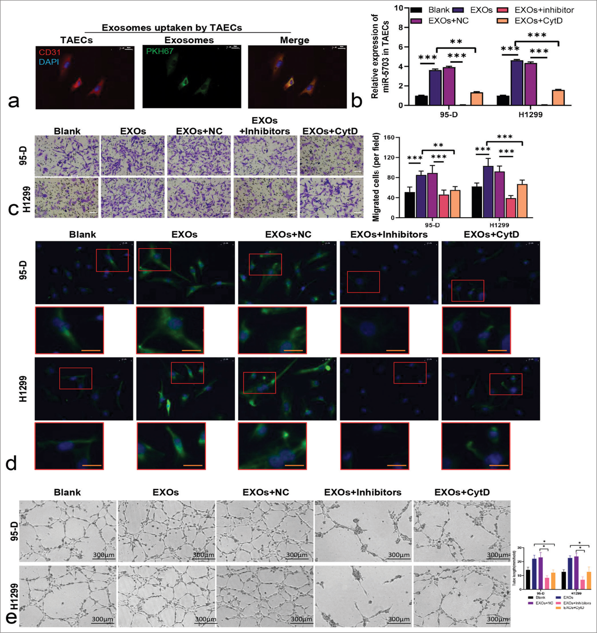 Lung cancer cell-derived exosomes encapsulating microRNA-5703 (miR-5703) regulate EndMT, angiogenic ability, and cell adjunction in tumor-associated endothelial cells (TAECs). (a) Confocal microscopy images Ashowing PKH67-labeled exosome uptake by TAECs after co-culturing. Scale: 20 μm. (b) Quantitative polymerase chain reaction analysis revealing increased miR-5703 levels in TAECs co-cultured with exosomes or treated with cytochalasin D. (c) Migration assay demonstrating the enhanced migratory capacity of TAECs. Scale: 50 μm. (d) α-smooth muscle actin expression was measured through immunofluorescence. Scale: 20 μm. (e) The angiogenesis of TAECs was evaluated using tube formation assay. ✶P < 0.05, ✶✶P < 0.01, ✶✶✶P < 0.001. EXOs: exosomes; NC: Negative Control.