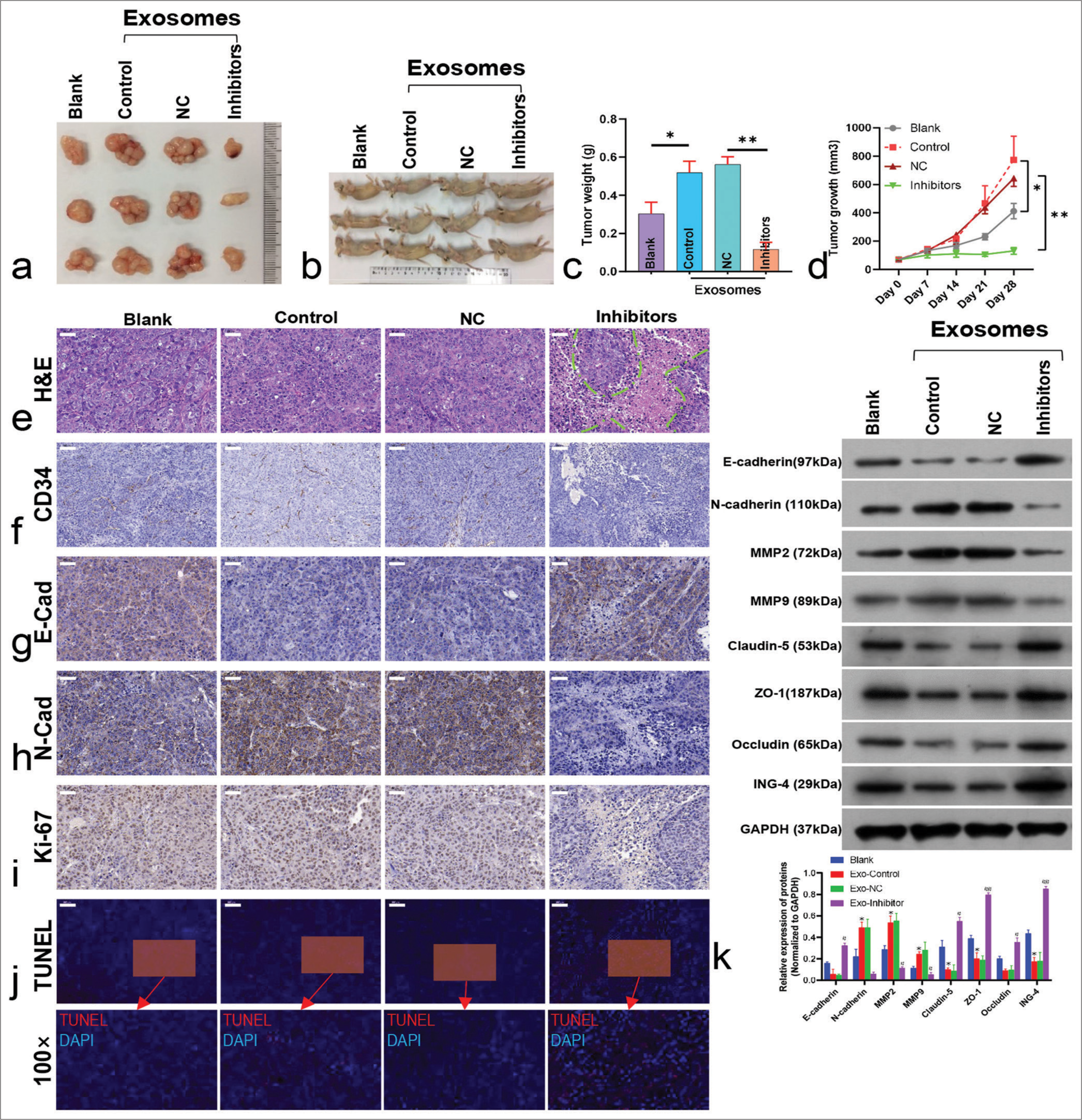 Exosomal microRNA-5703 (miR-5703) and its inhibition affect tumor growth and protein expression. (a-d) Exosome treatment increased tumor volume and mass, but this effect was reversed by miR-5703 inhibitors. ✶P < 0.05, ✶✶P < 0.01. (e) Hematoxylin and eosin staining (H&E) showed apoptotic regions after miR-5703 inhibitor treatment. Green dotted lines highlighted the areas of tissue apoptosis and necrosis. (f-i) Immunohistochemical analysis revealed the altered expression of Cluster of Differentiation 34 (CD34) (f), N-cadherin (N-Cad, g), E-cadherin (E-Cad, h), and Kiloelectron Volts 67 (Ki-67). (i), in response to treatments. (j) Terminal deoxynucleotidyl transferase dUTP nick end labeling assay (TUNEL) indicated enhanced apoptosis with miR-5703 inhibitors. (k) Western blot analysis demonstrated changes in the expression of claudin-5, Zonula Occludens-1 (ZO-1), occludin, and Inhibitor of growth family, member 4 due to exosome and inhibitor treatments. MMP2: Matrix Metalloproteinase-2; MMP9: Matrix Metalloproteinase-9; ZO-1: Zonula Occludens-1; ING4: INhibitor of Growth 4; GADPH: glyceraldehyde-3-phosphate dehydrogenase. Scale: 50 μm. n = 5, ✶P < 0.05, ✶✶P < 0.01 versus Blank; #P < 0.05, ##P < 0.01 versus Exo-negative control. NC: Negative Control.