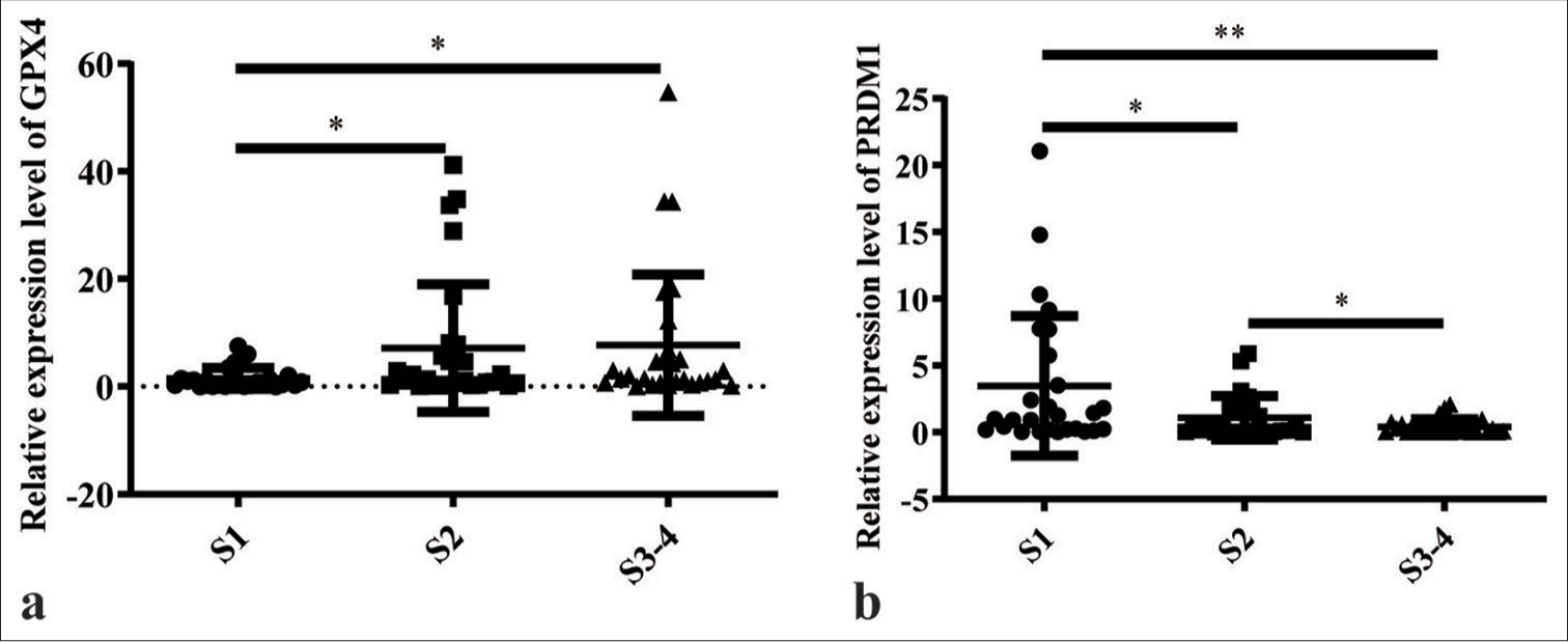 Messenger ribonucleic acid (mRNA) levels of GPX4 and PRDM1 in different degrees of liver fibrosis. (a) mRNA levels of GPX4 in liver tissues with different degrees of hepatic fibrosis. (b) mRNA levels of PRDM1 in liver tissues with different degrees of hepatic fibrosis. S1: Mild fibrosis; S2: Moderate fibrosis; S3–S4: Advanced fibrosis and above; ✶P<0.05; ✶✶P<0.01. PRDM1: PR/SET domain 1, GPX4: Glutathione peroxidase 4.