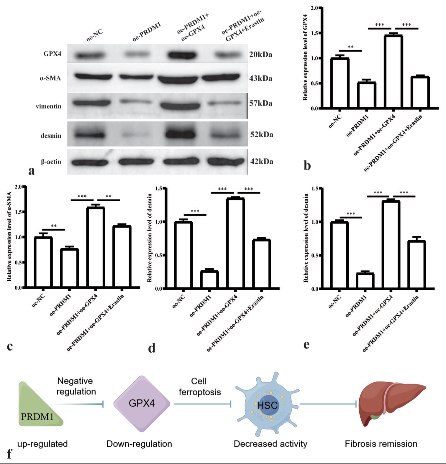 Simultaneous overexpression of PRDM1 and GPX4 inhibits the expression of active proteins in HSCs. (a) Western blot plots of GPX4 and HSC cell activation marker proteins a-SMA, vimentin, and desmin in the oe-NC, oe-PRDM1, oe-PRDM1+oe-GPX4, and oe-PRDM1+oe-GPX4+Erastin groups. (b-e) Statistical graph of the expression of the abovementioned proteins in different cells. ✶✶: P<0.01; ✶✶✶: P<0.001. (f) Pathway of PRDM1-GPX4 in HSCs. Each experiment was repeated three times. PRDM1: PR/SET domain 1, GPX4: Glutathione peroxidase 4, HSC: Hepatic stellate cells, a-SMA: a-smooth muscle actin.