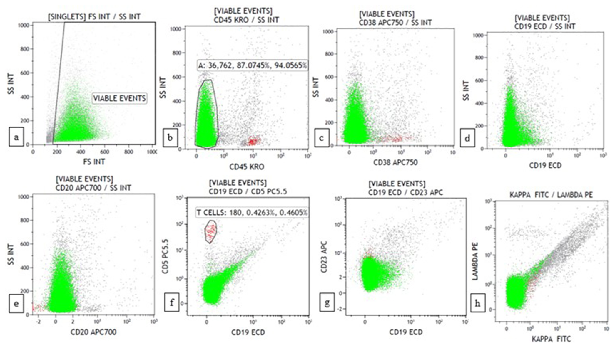 Flow cytometry plots of classic Hodgkin lymphoma-lymphocyte depleted show 94% events in the CD45 negative region with a background minor population of reactive cells. (a) forward scatter (FSC) versus side scatter (SSC) (b) CD45 versus SSC (c) CD38 versus SSC (d) CD19 versus SSC (e) CD20 versus SSC (f) CD19 versus CD5 (g) CD19 versus CD23 (h) Kappa versus lambda.