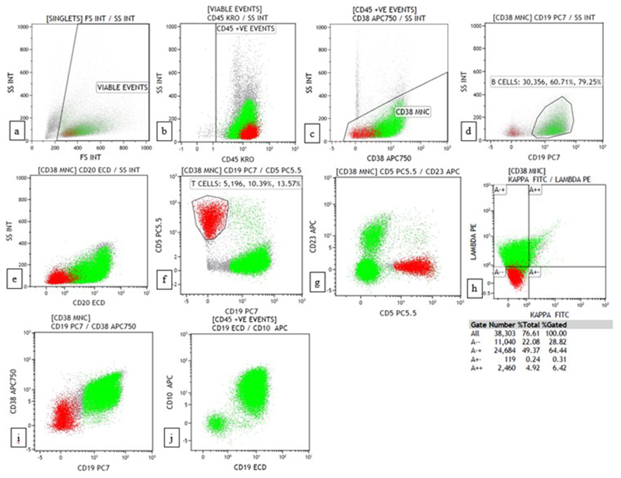 Flow cytometry plots of Burkitt lymphoma showing CD45+ with high SSC, CD19+, CD20+, CD5-, CD23-, CD38+, lambda restricted, CD10+. (a) forward scatter (FSC) versus side scatter (SSC) (b) CD45 versus SSC (c) CD38 versus SSC (d) CD19 versus SSC (e) CD20 versus SSC (f) CD19 versus CD5 (g) CD5 versus CD23 (h) Kappa versus lambda (i) CD19 versus CD38 (j) CD19 versus CD10.