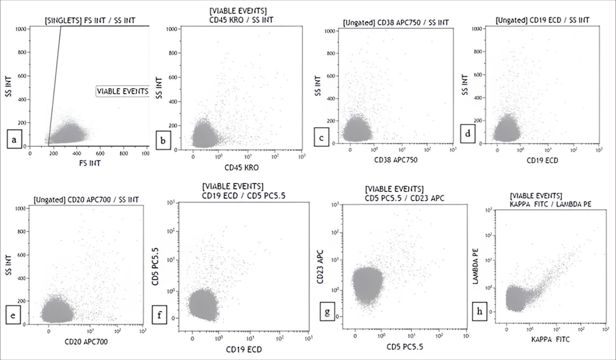 Flow cytometry plots of poorly differentiated malignancy mimicking lymphoma showing discrete clusters of cells that are negative for all CD markers. (a) forward scatter (FSC) versus side scatter (SSC) (b) CD45 versus SSC (c) CD38 versus SSC (d) CD19 versus SSC (e) CD20 versus SSC (f) CD19 versus CD5 (g) CD5 versus CD23 (h) Kappa versus lambda.