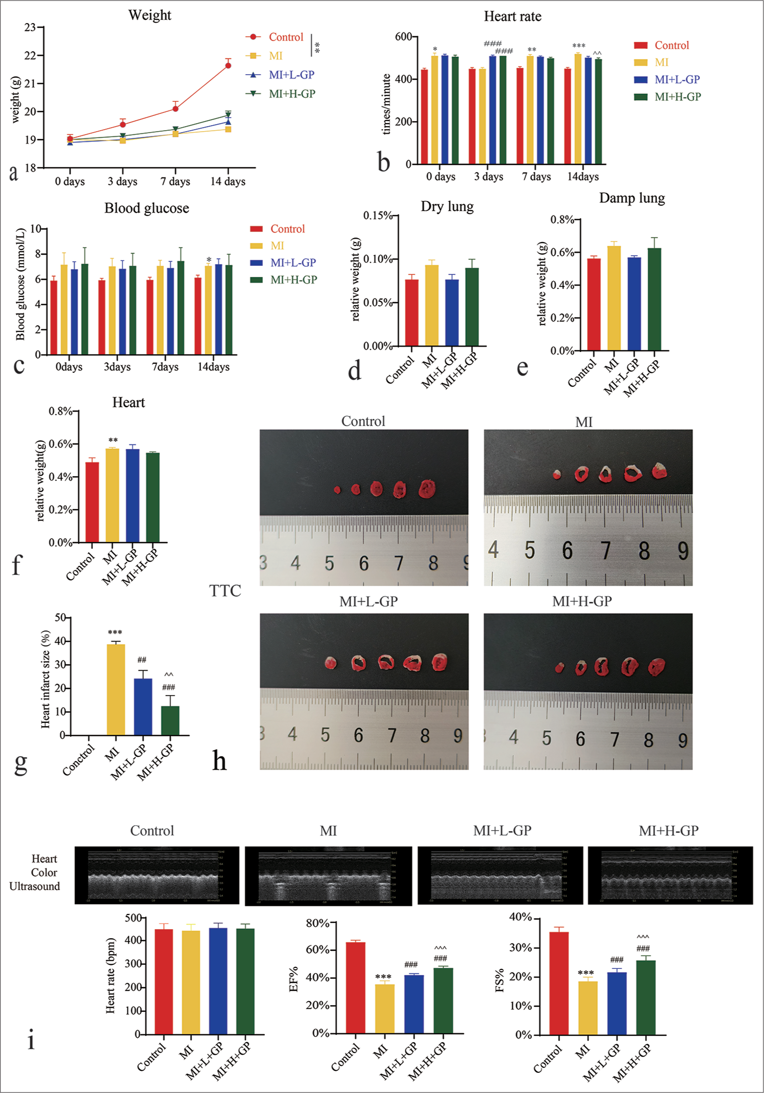 Effects of Geniposide (GP) treatment on physiological indicators and heart infarct size in myocardial infarction (MI) mice (n = 8). (a) Weight, (b) heart rate, (c) blood glucose, (d) wet lung relative weight, (e) dry lung relative weight, (f) heart relative weight, (g and h) heart infarct size, and (i) heart structure and function. Compared with the control group, ✶P < 0.05, ✶✶P < 0.01, ✶✶✶P < 0.001; compared with the MI group, ##P < 0.01, ###P < 0.001; compared with the MI + Low (L)-GP group, ^^P < 0.01, ^^^P < 0.001.