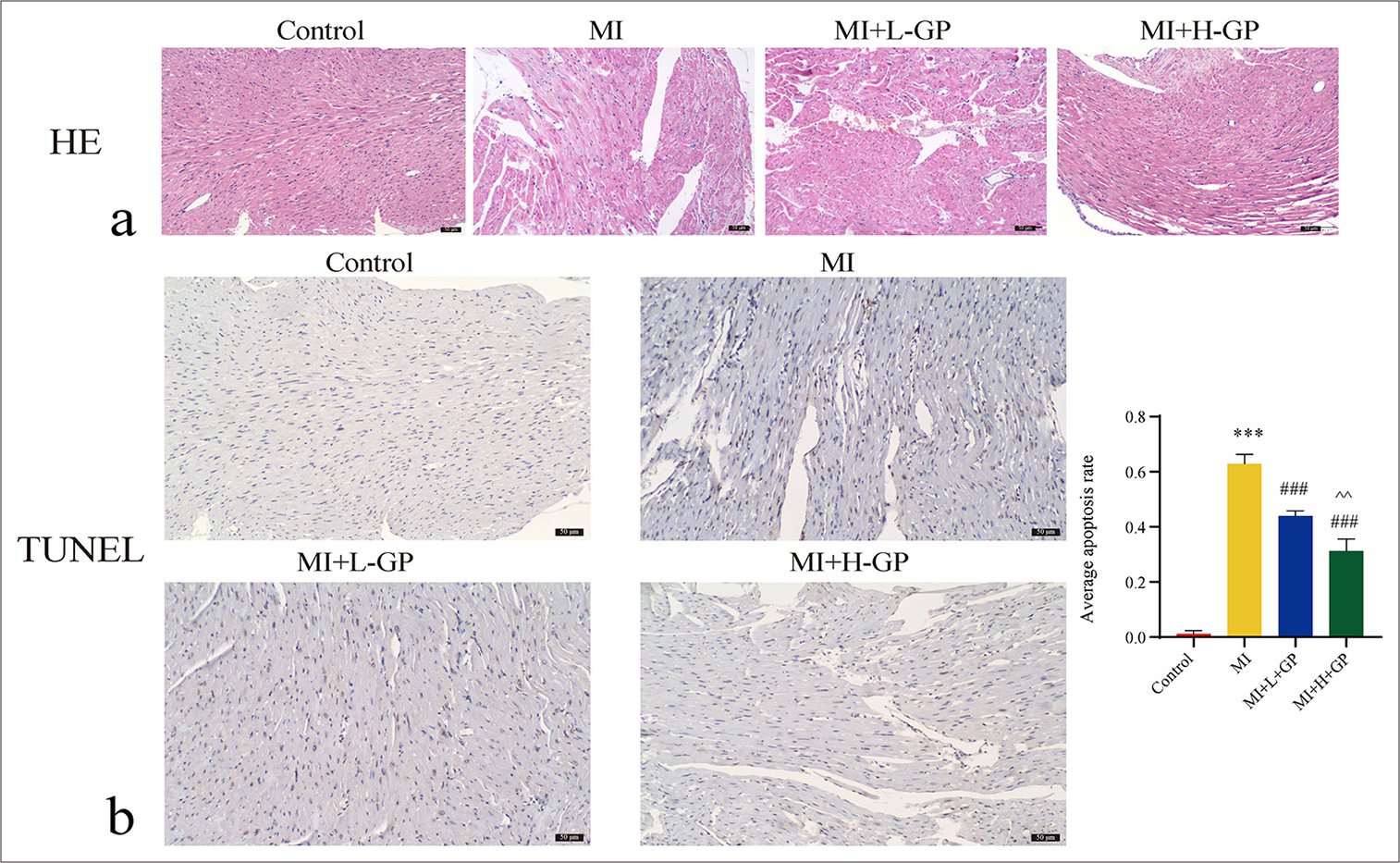 Myocardial tissues of each group of mice were subjected to hematoxylin–eosin (HE) and terminal deoxynucleotidyl transferase 2’-deoxyuridine 5’-triphosphate nick end labeling (TUNEL) staining (scale bar = 50 µm) (n = 3). (a) HE (×200), (b) TUNEL (×200). Compared with the control group, ✶✶✶P < 0.001; compared with the myocardial infarction (MI) group, ###P < 0.001; compared with the MI + L-Geniposide group, ^^P < 0.01.