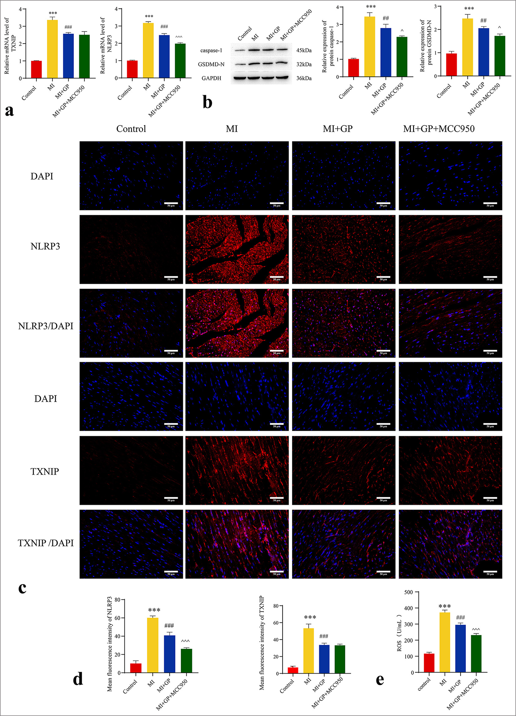 Effects of NOD-like receptor protein 3 (NLRP3) inhibitors on the expression of NLRP3, thioredoxin-interacting protein (TXNIP), caspase-1, gasdermin D N-terminal (GSDMD-N), and reactive oxygen species (ROS) levels in cardiac tissue during Geniposide (GP)-mediated anti-pyroptosis (n = 3). (a) mRNA level of NLRP3, TXNIP; (b) expression of caspase-1 and GSDMD-N; (c and d) NLRP3 (Immunofluorescence [IF]: ×400, scale bar = 50 µm) and TXNIP (IF: ×400, scale bar = 50 µm); (e) ROS. Compared with the control group, ✶✶✶P < 0.001; as compared with the myocardial infarction (MI) group, ##P < 0.01, ###P < 0.001; as compared with the MI + GP group, ^P < 0.05, ^^^P < 0.001. GAPDH: Glyceraldehyde-3-phosphate dehydrogenase, DAPI: 4’,6-diamidino-2-phenylindole, MCC950: NLRP3 inhibitor.