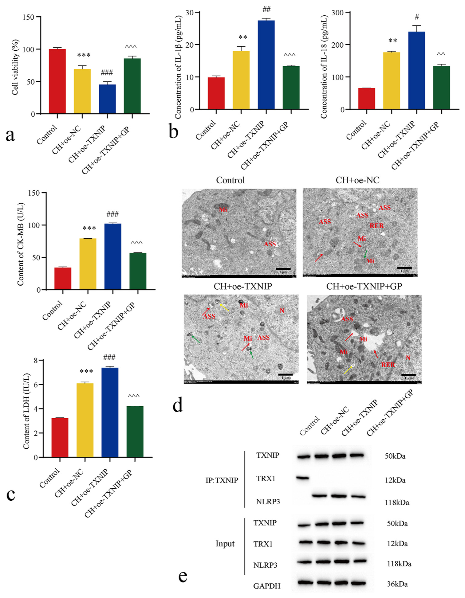 Geniposide (GP) inhibits the thioredoxin-interacting protein (TXNIP)/NLRP3 signaling pathway to counter chronic hypoxia (CH)-Induced myocardial cell necrosis (n = 3). (a) Cell counting kit-8 detected cell viability; (b and c) enzyme-linked immunosorbent assay-detected interleukin (IL)-1β, IL-18, lactate dehydrogenase (LD), and creatine kinase-myocardial band (CK-MB) levels; (d) Transmission electron microscopy-detected cell pyroptosis. N: Nucleus, Mi: Mitochondria, ASS: Autophagolysosome, ERE: Rough endoplasmic reticulum, red arrow: Mitochondrial membrane rupture, green arrow: Mitochondrial deformation and shrinkage, yellow arrow: Mitochondrial vacuolation. (e) Immunoprecipitation-detected interaction between TXNIP and NLRP3. Compared with the control group, ✶✶P < 0.05, ✶✶✶P < 0.001; as compared with the CH + overexpression (oe)-NC group, #P < 0.05, ##P < 0.01, ###P < 0.001; as compared with the CH + oe-TXNIP group, ^^P < 0.01, ^^^P < 0.001. oe-NC: Overexpressing negative control, NLRP3: NOD-like receptor protein 3, TRX: Thioredoxin.