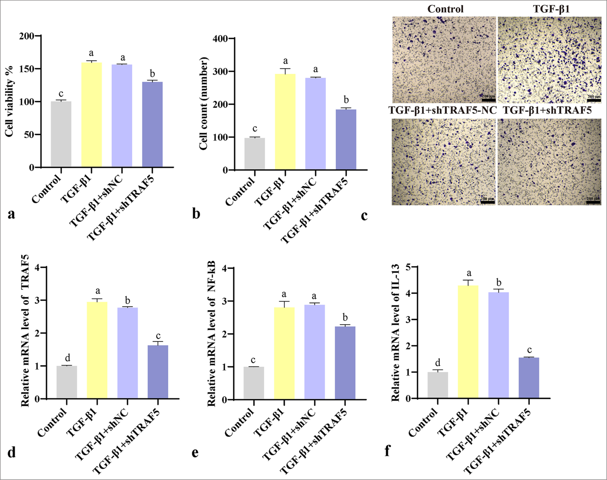 Cellular experiments validate the effect of TRAF5 on PFCD. (a) CCK-8 detects cell proliferation. (b and c) Transwell detects cell migration (scale bar = 200 μm). (d-f) qPCR detection of TRAF5, NF-κB, and IL-13 mRNA expression levels. The different letters represent the significance level (P < 0.05), (n = 3). TGF-β1: Transforming growth factor-beta 1, TRAF5: Tumor necrosis factor receptor-associated factor 5, PFCD: Perianal fistulizing Crohn’s disease, CCK-8: Cell counting kit-8, qPCR: Quantitative polymerase chain reaction, NF-κB: Nuclear factor-kappa B, IL-13: Interleukin 13, shNC: Short hairpin negative control.