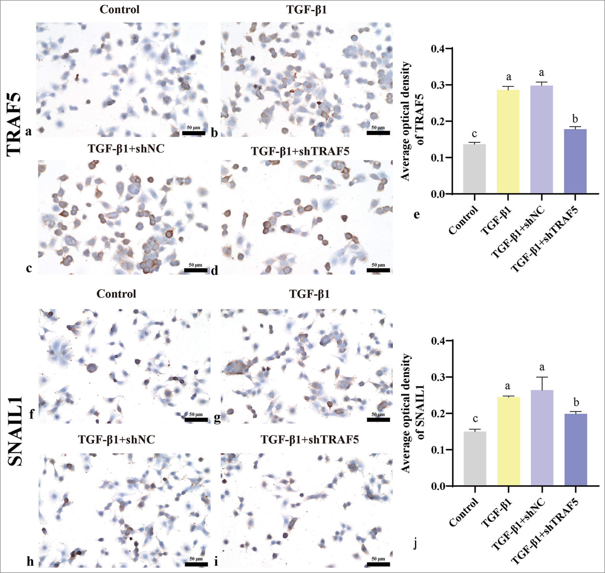 TRAF5 and SNAIL1 protein expression levels (scale bar = 50 μm). (a-e) Immunohistochemistry was used to detect the protein levels of TRAF5 (×400); (f-j) Immunohistochemistry was used to detect the protein levels of SNAIL1 (×400). The different letters represent the significance level (P < 0.05), n = 3. TGF-β1: Transforming growth factor-beta 1, TRAF5: Tumor necrosis factor receptor-associated factor 5, SNAIL1: Snail family transcriptional repressor 1, shNC: short hairpin negative control.