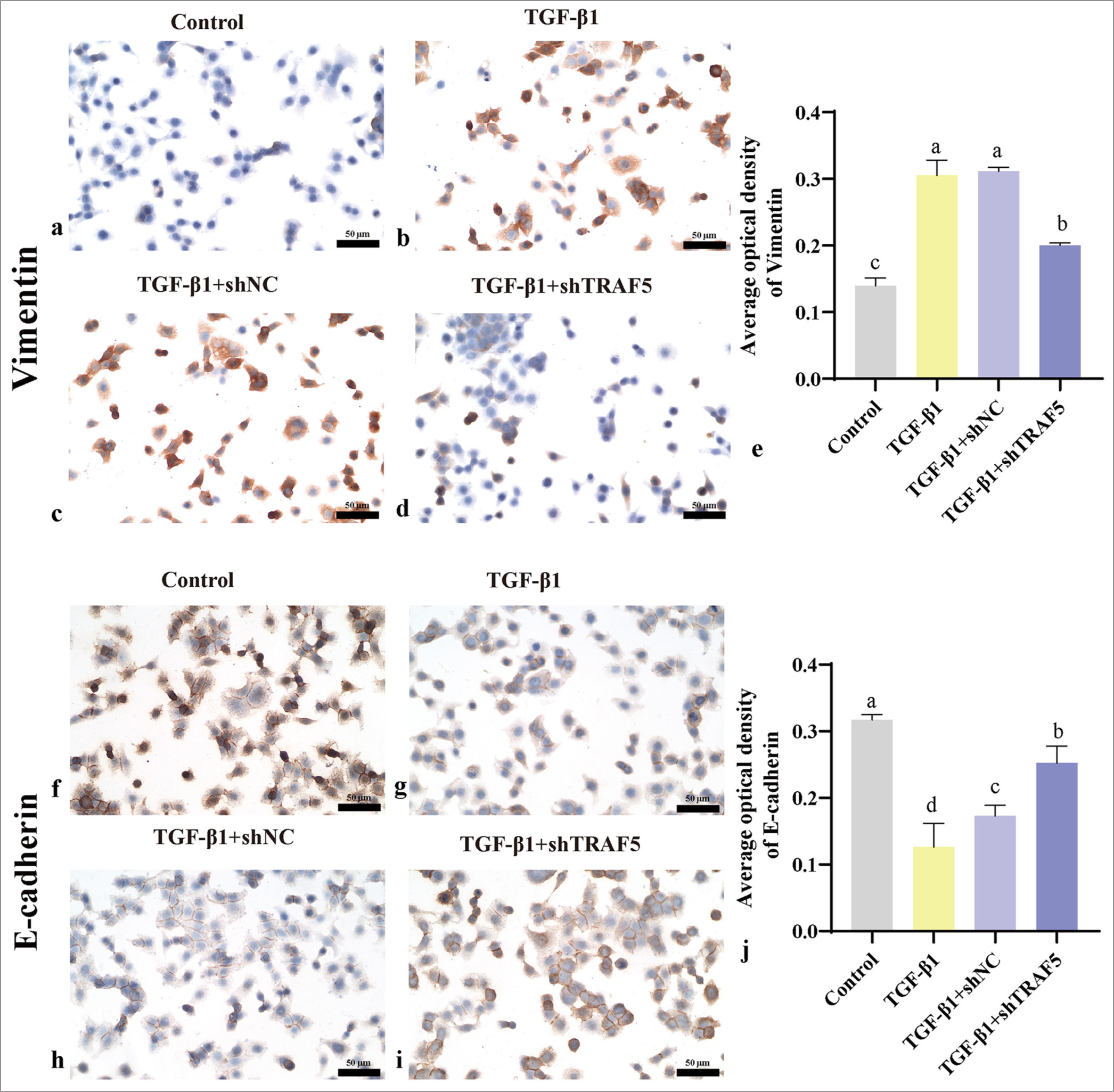 Vimentin and E-cadherin protein expression levels (scale bar = 50 μm). (a-e) Immunohistochemistry was used to detect the protein levels of vimentin (×400); (f-j) Immunohistochemistry was used to detect the protein levels of E-cadherin (×400). The different letters represent the significance level (P < 0.05), n = 3. E-cadherin: Epithelial cadherin, TGF-β1: Transforming growth factor-beta 1, TRAF5: Tumor necrosis factor receptor-associated factor 5, shNC: short hairpin negative control.