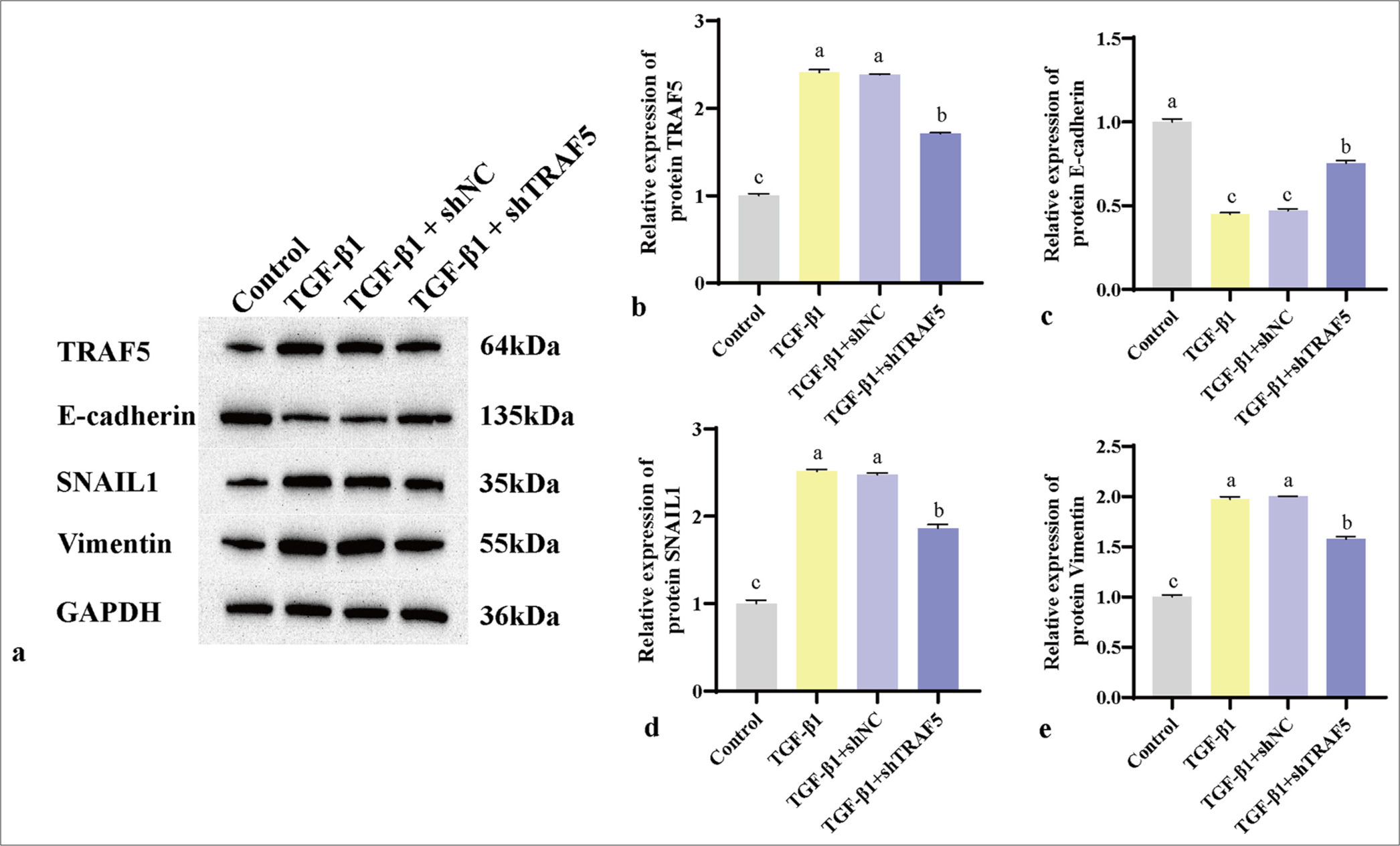 (a-e) WB was used to detect the protein levels of TRAF5, E-cadherin, SNAIL1, and vimentin. The different letters represent the significance level (P < 0.05), n = 3. SNAIL1: Snail family transcriptional repressor 1, TRAF5: Tumor necrosis factor receptor-associated factor 5, WB: Western blot, TGF-β1: Transforming growth factor-beta 1, GAPDH: Glyceraldehyde-3-phosphate dehydrogenase, shNC: Short hairpin negative control.