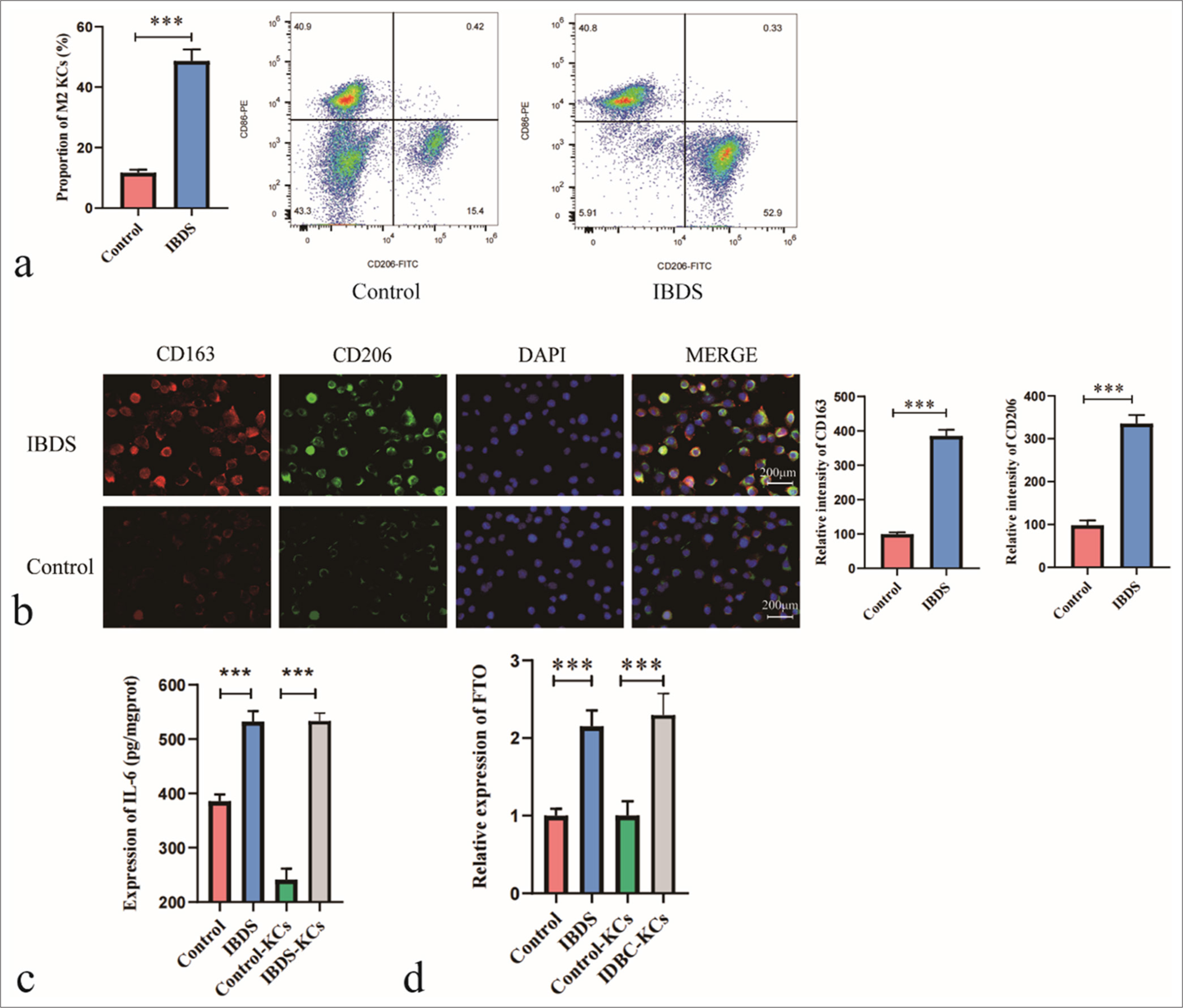 Increased proportion of M2-polarized Kupffer cells (KC) and elevated fat mass and obesity-associated (FTO) expression in patients with intrahepatic bile duct stone (IBDS). (a) Flow cytometry analysis of the proportion of M2-polarized KC in patients with IBDS relative to that in the control group. (b) Immunofluorescence analysis of M2-polarized KC markers CD163 and CD206. (c) Enzyme-linked immunosorbent assay analysis of IL-6 levels in KC. (d) Quantitative polymerase chain reaction analysis of FTO expression levels in KC. ✶✶✶P < 0.001. DAPI: 4’,6-Diamidino-2-phenylindole.