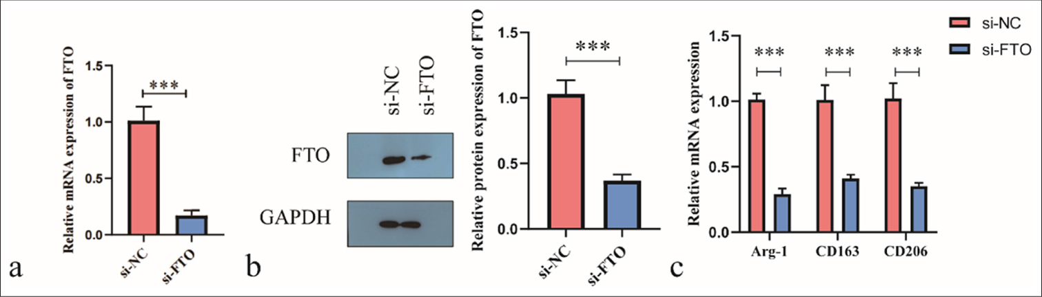 Silencing of fat mass and obesity-associated (FTO) inhibits the M2 polarization of Kupffer cells. (a and b) FTO abundance was evaluated using real-time quantitative polymerase chain reaction (RT-qPCR) and Western blot. (c) RT-qPCR was used to assess the levels of CD163, Arg-1, and CD206. ✶✶P < 0.01, ✶✶✶P < 0.001. si-NC: Negative control si-RNA.