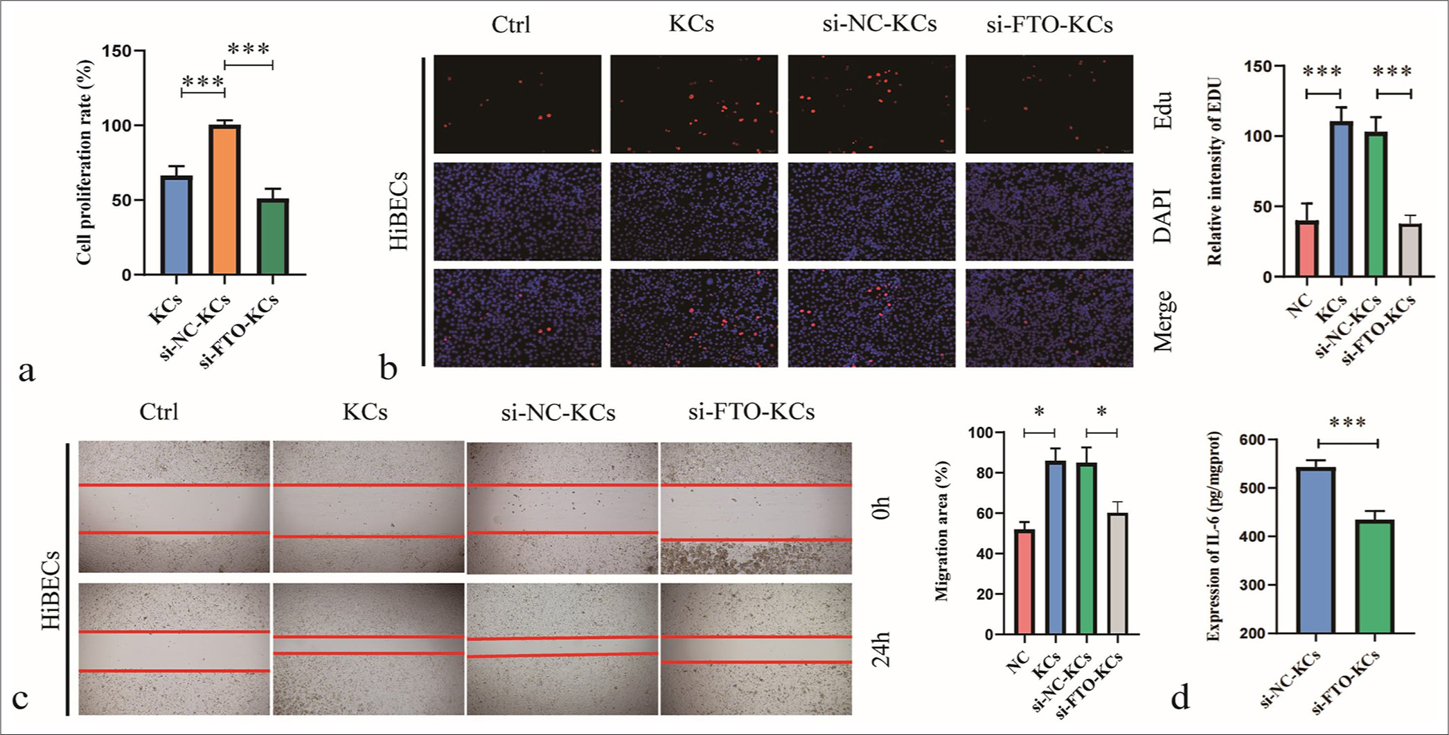 Silencing fat mass and obesity-associated (FTO) inhibits the effects of M2-polarized Kupffer cells (KC) on human intrahepatic biliary epithelial cells. (a) Cell counting kit-8 assay was used to detect cell viability relative to that of the NC group. (b) Cell proliferation was analyzed by 5-ethynyl-2'-deoxyuridine assay. (c) Cell migration was evaluated by wound healing assay. (d) interleukin-6 production was measured by Enzyme-linked immunosorbent assay. ✶P < 0.05, ✶✶P < 0.01, ✶✶✶P < 0.001. NC: negative control.