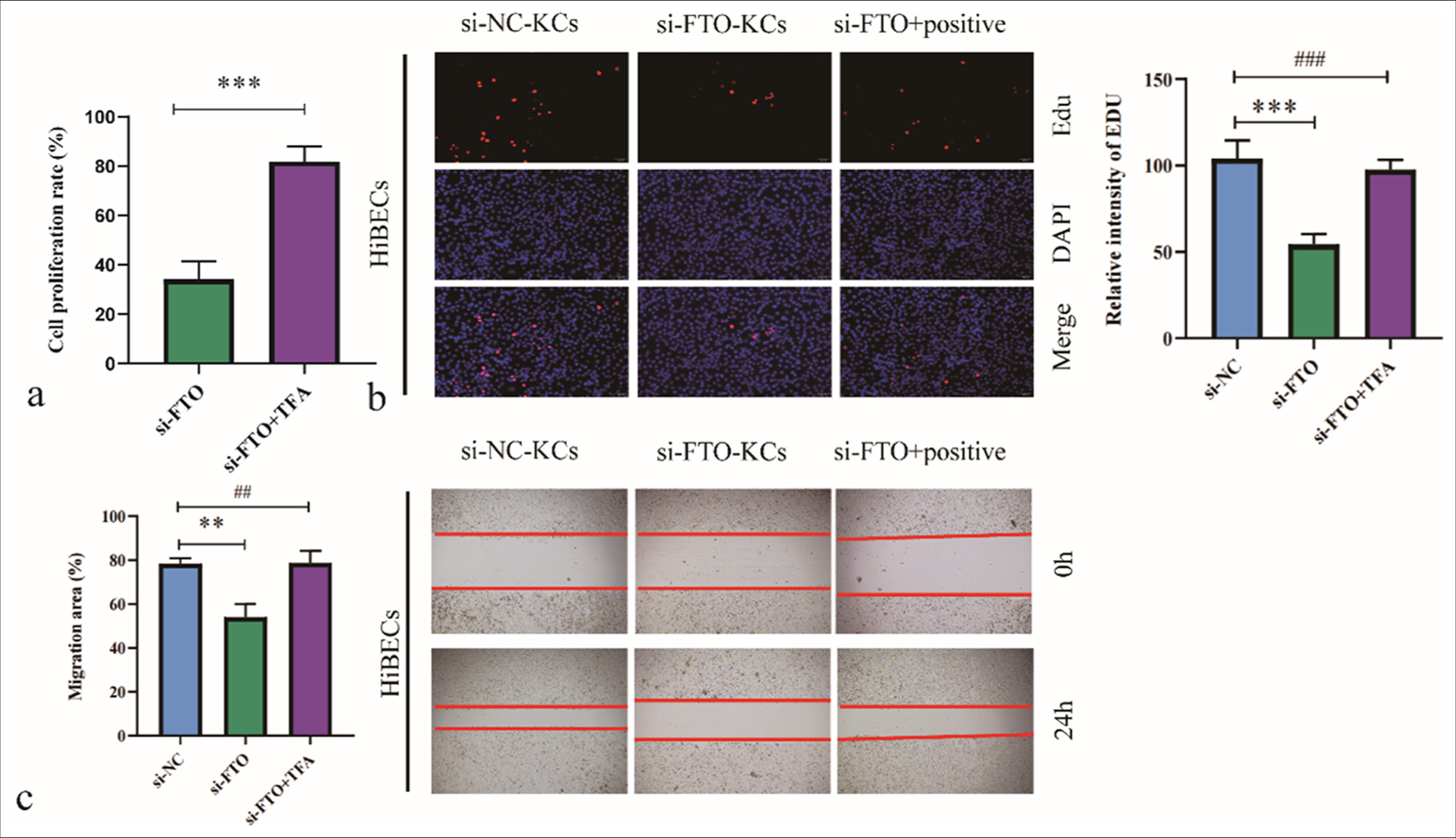 Activation of the c-Jun N-terminal kinase/p38 signaling pathway blocks the effects of fat mass and obesity-associated (FTO) silencing on M2-polarized Kupffer cell (KC)-mediated human intrahepatic biliary epithelial cell proliferation and migration. (a) Cell viability was assessed by cell counting kit-8 assay. (b) Cell proliferation was analyzed by 5-ethynyl-2’-deoxyuridine assay. (c) Cell migration was evaluated by wound healing assay. ✶✶P < 0.01, ✶✶✶P < 0.001. si-NC: negative control si-RNA, TFA: Trifluoroacetic acid. ##/###: No significant difference.