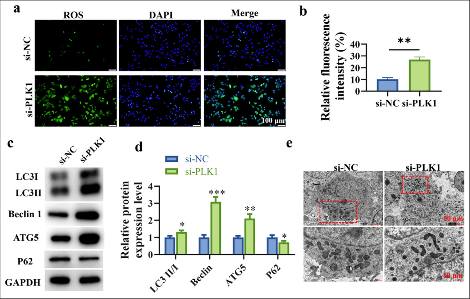 Silencing of PLK1 promotes autophagy in lung cancer cells and inhibits cancer progression. (a and b) Induction of ROS increase in lung cancer cells through silencing of PLK1. (c and d) Induction of autophagy in lung cancer cells through silencing of PLK1. (e) Accumulation of autophagosomes in lung cancer cells through PLK1 silencing. n = 3 (✶P < 0.05, ✶✶P < 0.01, ✶✶✶ P < 0.001). PTEN: Phosphatase and tensin homolog deleted on chromosome ten, ATG5: Autophagy protein 5, PLK1: Polo-like kinase 1, ROS: Reactive oxygen species, Ov-NC: negative control to overexpression plasmid, Ov-PTEN: PTEN overexpression plasmid.