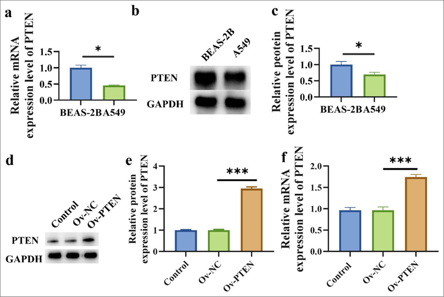 PTEN expression is reduced in lung cancer cells. (a) Transcription level of PTEN. (b and c) Protein level of PTEN. (d and e) PTEN protein expression level after PTEN overexpression in A549 cells. (f) PTEN mRNA expression level after PTEN overexpression in A549 cells. n=3. (✶P < 0.05, ✶✶✶P < 0.001).