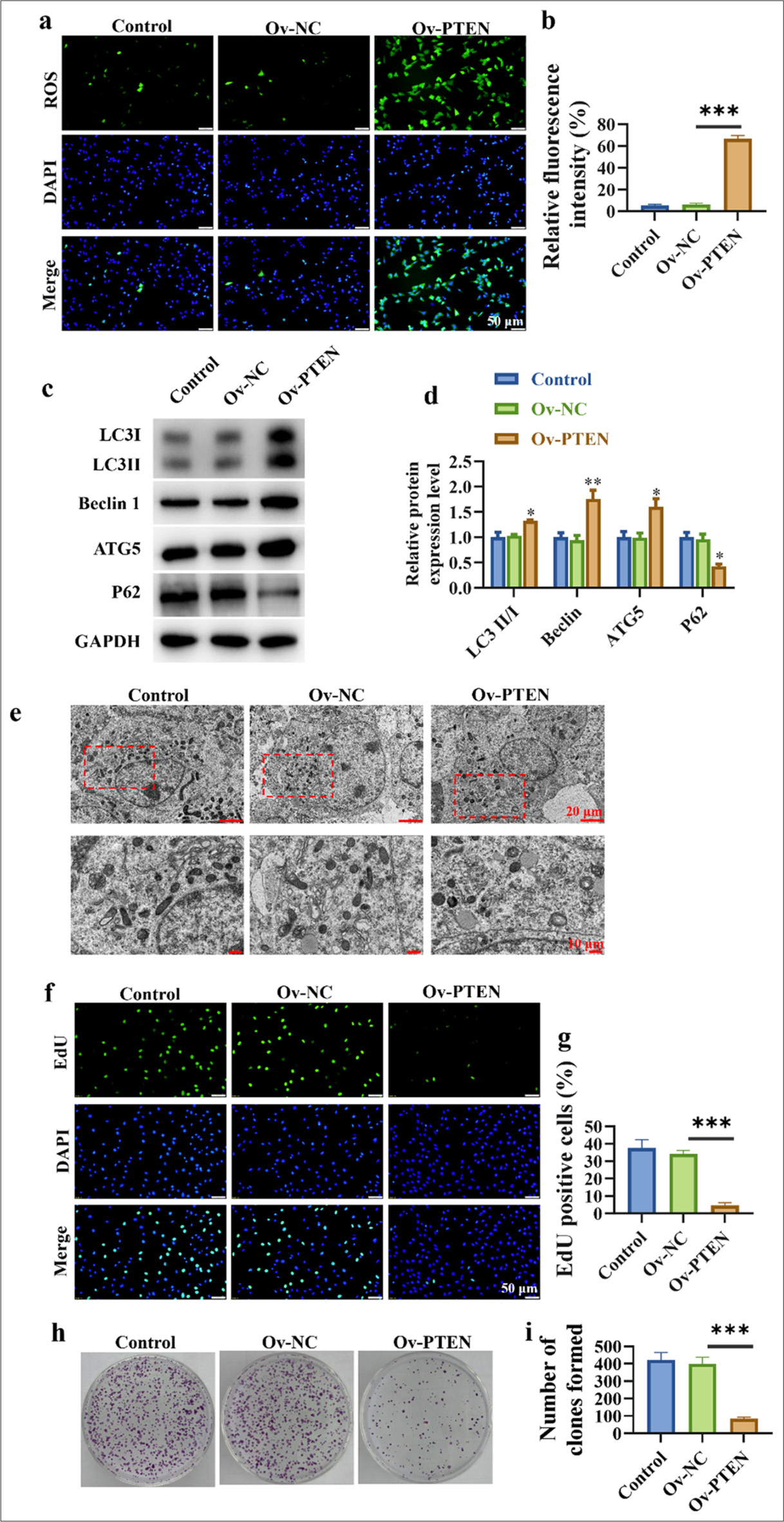 Up-regulation of PTEN promotes autophagy and inhibits the proliferation of lung cancer cells. (a and b) Detection of ROS levels in cells. (c and d) Promotion of autophagy-related protein expression in lung cancer cells. (e) Accumulation of autophagosomes in lung cancer cells. (f and g) Dose-dependent inhibition of lung cancer cell proliferation. (h and i) Dose-dependent inhibition of clonogenic capacity in lung cancer cells. n=3 (✶P < 0.05, ✶✶ P < 0.01, ✶✶✶ P < 0.001).