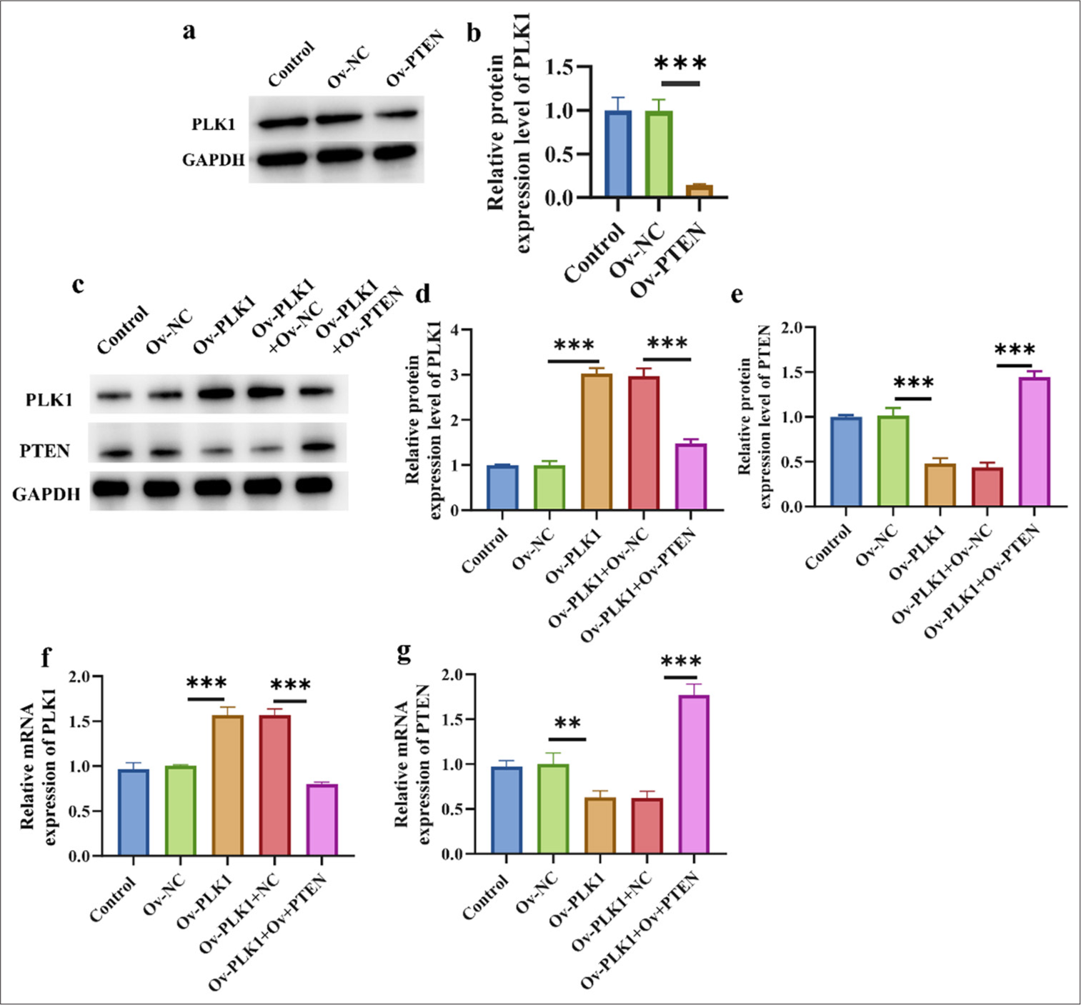 Up-regulation of PTEN inhibited PLK1. (a and b) Effect of PTEN overexpression on PLK1 protein expression. (c-e) Western blot verified the efficiency of overexpressions of PLK1 and PTEN. (f and g) RT-qPCR verified the efficiency of overexpressions of PLK1 and PTEN. n = 3 ✶✶P < 0.01, ✶✶✶ P < 0.001. Ov-PLK1: PLK1 overexpression plasmid, Ov-PLK1+Ov-NC: negative control to overexpression plasmid, Ov-PLK1+ Ov-PTEN: PTEN and PLK1 overexpression plasmid, RT-qPCR: Real-time quantitative polymerase chain reaction.