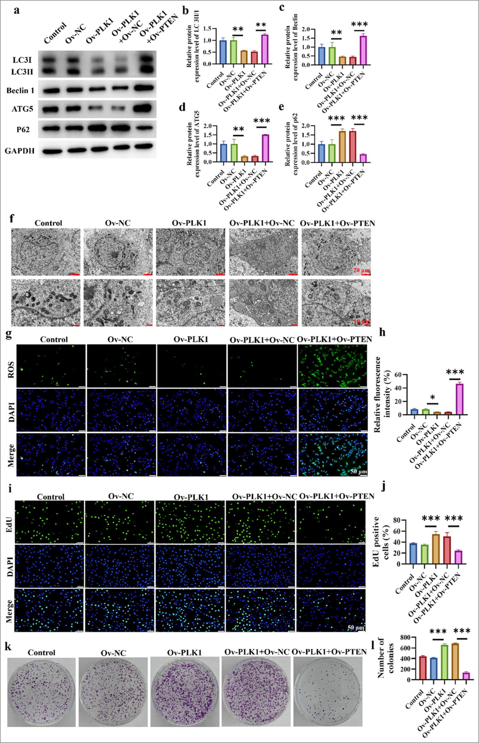 PTEN overexpression counteracts the oncogenic effects of the PLK1 gene. (a-e) Expression of autophagy-related proteins in lung cancer cells in different treatment groups. (f) Promotion of autophagosome accumulation in lung cancer cells. (g and h) Detection of ROS levels in cells. (i and j) Cell viability assay of various treatment groups. (k and l) Clonogenic capacity assay of different treatment groups. n = 3 (✶P < 0.05, ✶✶ P < 0.01, ✶✶✶ P < 0.001).