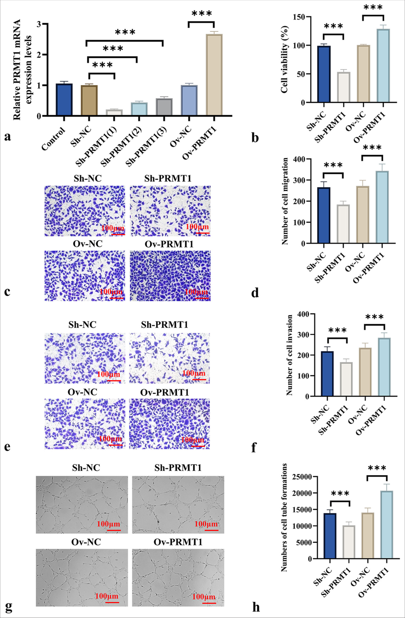 PRMT1 promotes CC cell migration and tube formation in HUVECs. (a) qRT-PCR analysis of mRNA expression efficiency following PRMT1 knockdown and overexpression. (b) CCK-8 assay to evaluate the effects of PRMT1 knockdown and overexpression on HeLa cell viability. (c-f) Transwell assays to assess the impact of PRMT1 knockdown and overexpression on HeLa cell migration and invasion. (g-h) Co-culture of transfected HeLa cells with endothelial cells, followed by tube formation assays to evaluate endothelial tube formation. Scale bar: 100 μm, magnification: ×200 (c, e, g). n = 6, ✶✶✶P < 0.001. PRMT1: Protein arginine methyltransferase 1, Sh-NC: ShRNA-negative control, Sh-PRMT1: ShRNA-protein arginine methyltransferase 1, Ov-NC: Overexpression-negative control, Ov-PRMT1: Overexpression-protein arginine methyltransferase 1, mRNA: Messenger RNA, qRT-PCR: Quantitative reverse transcription polymerase chain reaction.