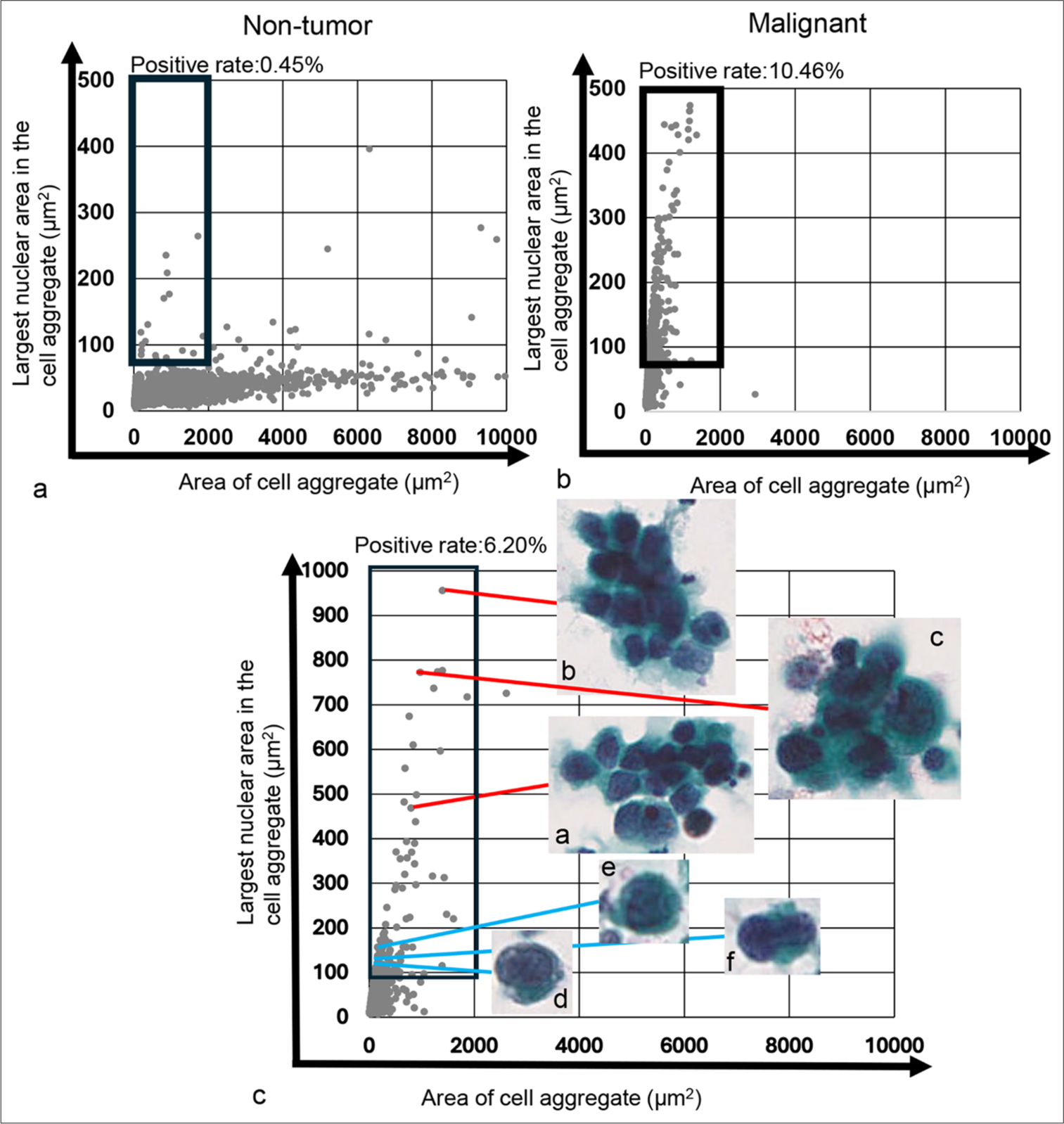 Plot of the cell/cell aggregate area and their largest nuclear area within the cell/cell aggregate, alongside actual cell image in the tumor-dominant area. (a) Scatter plot for the cytology-negative case (Case 34). (b) Scatter plot for the cytology-positive case (Case 190). The thick black square lines in both (a and b) indicate the tumor-dominant area. (c) Magnified scatter plot (Case 111) showing the distribution of individual tumor cells and small to medium-sized tumor cell clusters in the tumor-dominant area. The red line denotes the area of small to medium-sized tumor cell clusters and representative images of those clusters, respectively. The blue line indicates areas of individual tumor cells and representative images of those cells. Each cell or cell cluster area and maximum nuclear area shown in Figure 5c (a-f) were as follows: 1507.77 μm2 and 465.60 μm2 (a), 1625.28 μm2 and 993.72 μm2 (b), 1390.41 μm2 and 776.52 μm2 (c), 155.85 μm2 and 113.65 μm2 (d), 243.18 μm2 and 158.49 μm2 (e), and 152.19 μm2 and 118.98 μm2 (f), respectively.