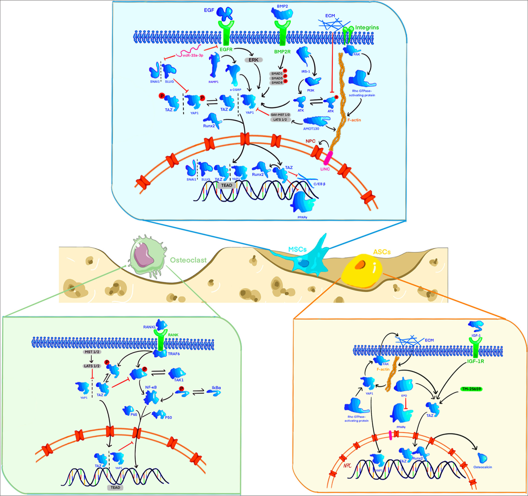 When yes-associated protein (YAP) or transcriptional co-activator with PDZ-binding motif (TAZ) is activated, it can mediate multiple signaling pathways to induce osteogenic differentiation of mesenchymal stem cells (MSCs), inhibit adipogenic differentiation of MSCs, inhibit the biological activity of osteoclasts, and promote the differentiation of adipose-derived stem cells (ADSCs) into osteoblasts. YAP/TAZ can mediate extracellular signals such as extracellular matrix stiffness and mechanical signal stimulation (Figure created using Adobe Illustrator CS6 Adobe Systems, San Jose, USA). AMOT130: Angiomotin 130, ATK: Akt, also known as protein kinase B, BMP2: Bone morphogenetic protein 2, BMP2R: Bone morphogenetic protein 2 receptor, CGRP: Calcitonin gene-related peptide, ECM: Extracellular matrix, EGF: Epidermal growth factor, EGFR: Epidermal growth factor receptor, EPO: Erythropoietin, ERK: Extracellular signal-regulated kinase, FAK: Focal adhesion kinase, F-actin: Filamentous actin, IGF-1: Insulin-like growth factor 1, IGF-1R: Insulin-like growth factor 1 receptor, IkBα: Inhibitor of kappa B alpha, IRS-1: Insulin receptor substrate 1, LATS 1/2: Large tumor suppressor 1/2, LINC: Long intergenic noncoding RNA, MSCs: Mesenchymal stem cells, NF-κB: Nuclear factor kappa-light-chain-enhancer of activated B cells, PI3K: Phosphoinositide 3-kinase, PPARγ: Peroxisome proliferator-activated receptor gamma, RAMP1: Receptor activity-modifying protein 1, RANKL: Receptor activator of nuclear factor kappa-B ligand, Runx2: Runt-related transcription factor 2, SAV-MST 1/2: Salvador/mammalian ste20-like kinase 1/2 signaling complex, SMAD: SMA and MAD related protein, SNAI1: Snail family transcriptional repressor 1, SNAI2: Snail family transcriptional repressor 2, TAK1: Transforming growth factor-beta-activated kinase 1, TAZ: Transcriptional co-activator with PDZ-binding motif, TEAD: Transcriptional enhanced associate domain, TRAF6: TNF receptor-associated factor 6, YAP: Yes-associated protein.