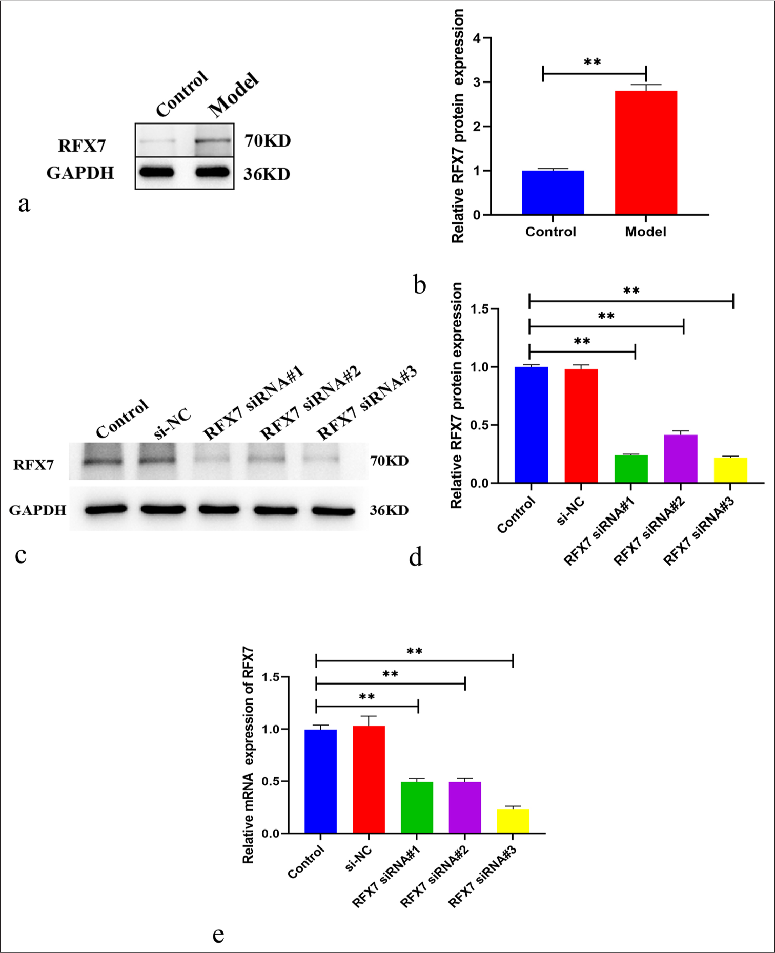 Regulatory factor X (RFX7) displays the notable overexpression in asthma cell models. (a) Representative Western blotting images of RFX7 in airway smooth muscle cells (ASMCs) administrated with 50 ng/mL platelet-derived growth factor-BB (PDGF-BB) or control. Glyceraldehyde-3-phosphate dehydrogenase (GAPDH) was utilized as a reference control. (b) Quantification analysis of RFX7 expression in control or PDGF-BB-induced ASMCs. (c) Representative Western blotting images of RFX7 in ASMCs in the context of small interfering-negative control (si- NC), RFX7 Small interfering RNAs (siRNA)#1, RFX7 siRNA#2, or RFX7 siRNA#3 transfection. (d) Quantification analysis of RFX7 expression in si-NC, RFX7 siRNA#1-, RFX7 siRNA#2-, or RFX7 siRNA#3-transfected ASMCs. (e) Representative reverse transcription quantitative polymerase chain reaction of RFX7 in ASMCs in the context of si-NC, RFX7 siRNA#1, RFX7 siRNA#2, or RFX7 siRNA#3 transfection. ✶✶ compared with the control group at P < 0.01. The experiment was repeated 3 times, n = 3.