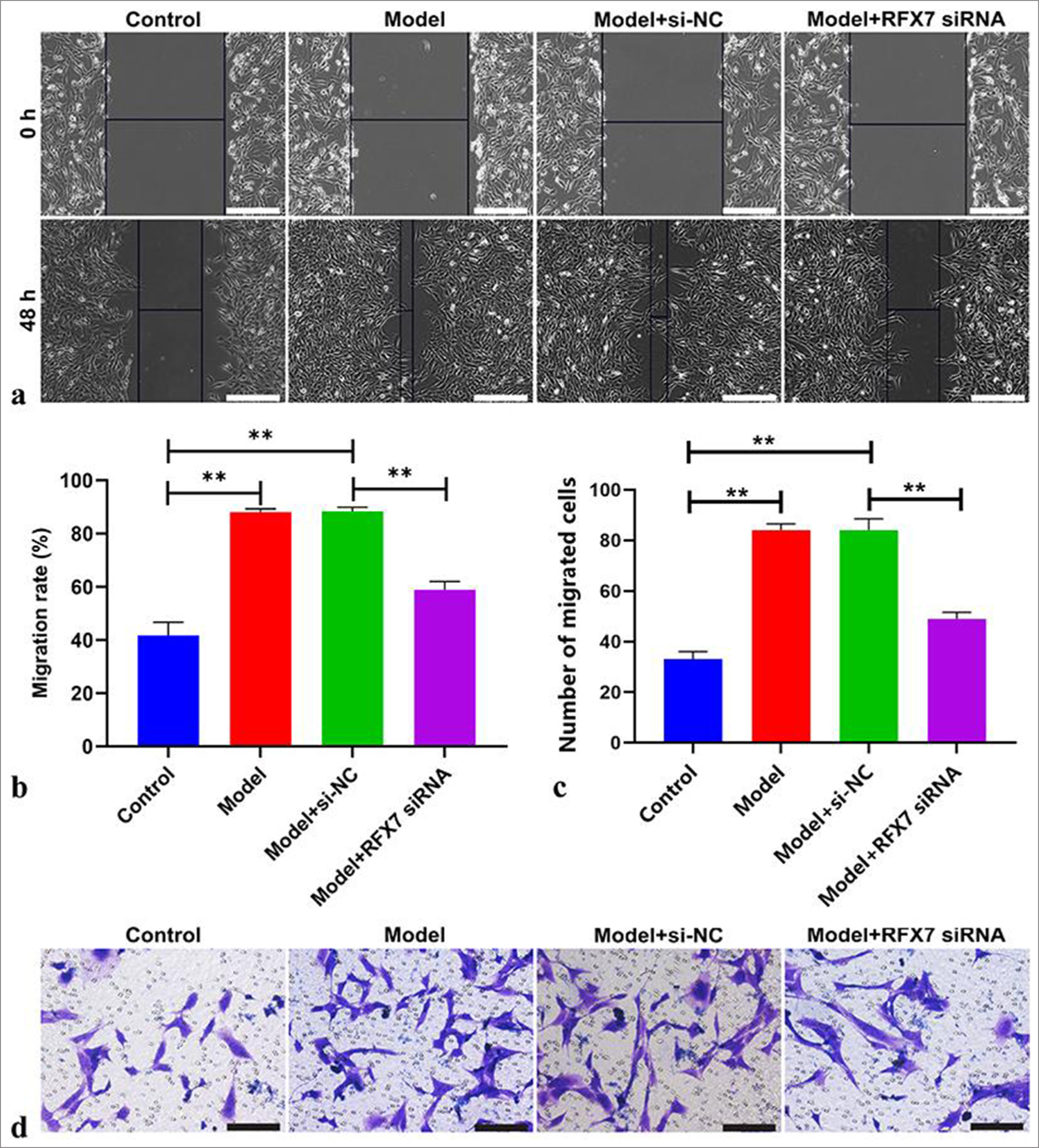 Targeting regulatory factor X7 (RFX7) ameliorates airway smooth muscle cell (ASMC) migration stimulated by platelet-derived growth factor-BB (PDGF-BB). (a) Representative photographs of wound healing assay in ASMCs with PDGF-BB stimulation or RFX7 small interfering RNAs (siRNA) transfection. Scale bar, 100 μm. (b) Quantification of the closure ratios of ASMCs with regard to PDGFBB treatment or RFX7 siRNA transfection. (c) Representative photographs of Transwell assay in ASMCs stimulated with PDGF-BB or transfected with RFX7 siRNAs. Cell mobility = (initial scratch width − final scratch width)/initial scratch width × 100%. (d) Quantification of migrative ASMCs with regard to PDGF-BB administration or transfection with RFX7 siRNAs. Scale bar, 50 μm.; ✶✶P < 0.01. The experiment was repeated 3 times, n = 3.