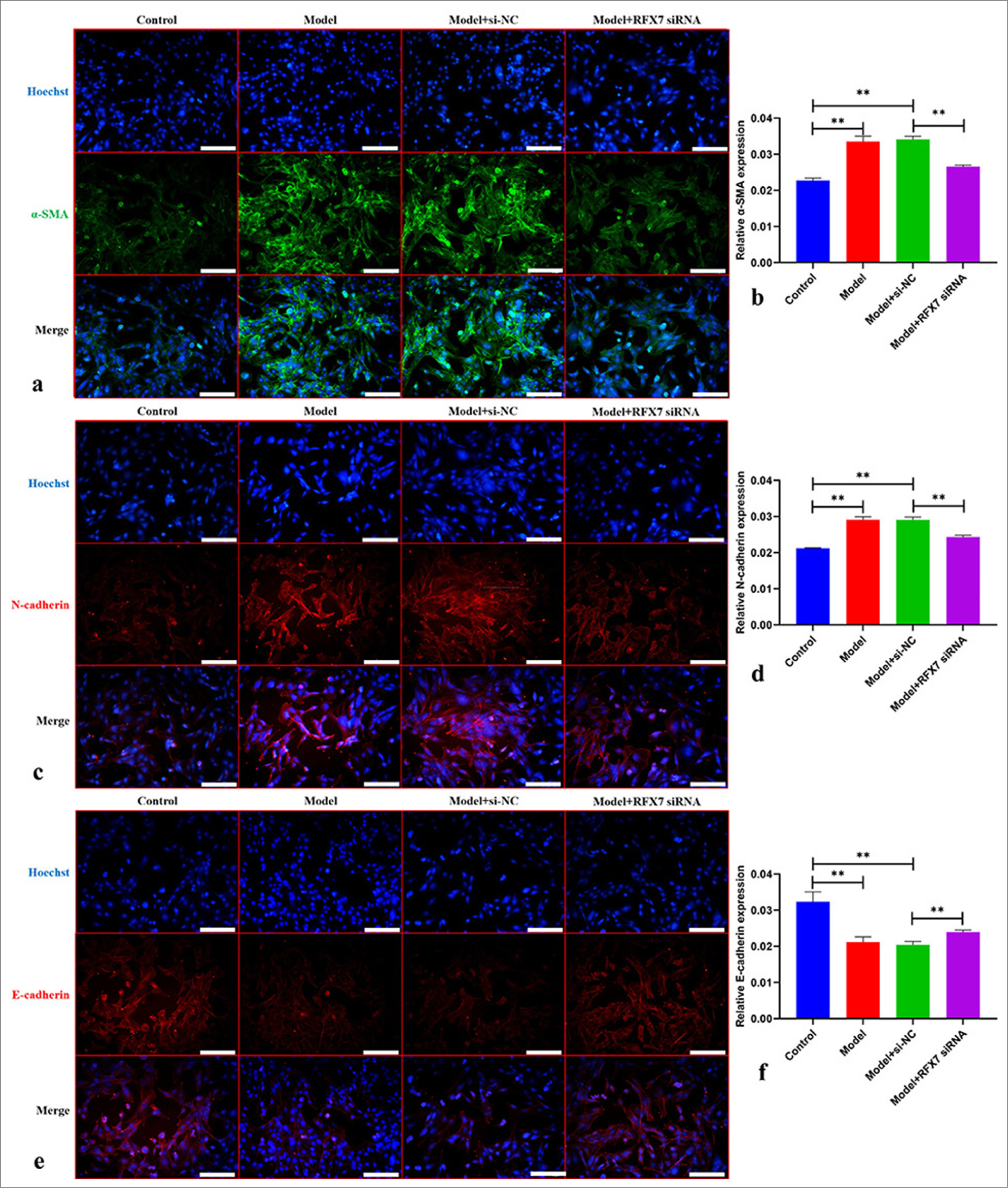 Silencing regulatory factor X7 (RFX7) weakens platelet-derived growth factor-BB (PDGF-BB)-stimulated airway smooth muscle cell (ASMC) remodeling. (a) Representative photographs of immunofluorescence on alpha smooth muscle actin (α-SMA) in ASMCs with PDGFBB stimulation or RFX7 small interfering RNAs (siRNA) transfection. Scale bar, 150 μm. (b) Quantification analysis on α-SMA in ASMCs with PDGF-BB stimulation or RFX7 siRNA transfection. (c) Representative photographs of immunofluorescence on N-cadherin in ASMCs administrated with PDGF-BB or transfected with RFX7 siRNAs. Scale bar, 150 μm. (d) Quantification analysis on N-cadherin in ASMCs administrated with PDGF-BB or transfected with RFX7 siRNAs. (e) Representative photographs of immunofluorescence on E-cadherin in ASMCs with regard to PDGF-BB stimulation or RFX7 siRNA transfection. Scale bar, 50 μm. (f) Quantification analysis on E-cadherin in ASMCs with regard to PDGF-BB stimulation or RFX7 siRNA transfection. ✶✶P < 0.01. The experiment was repeated 3 times, n = 3.